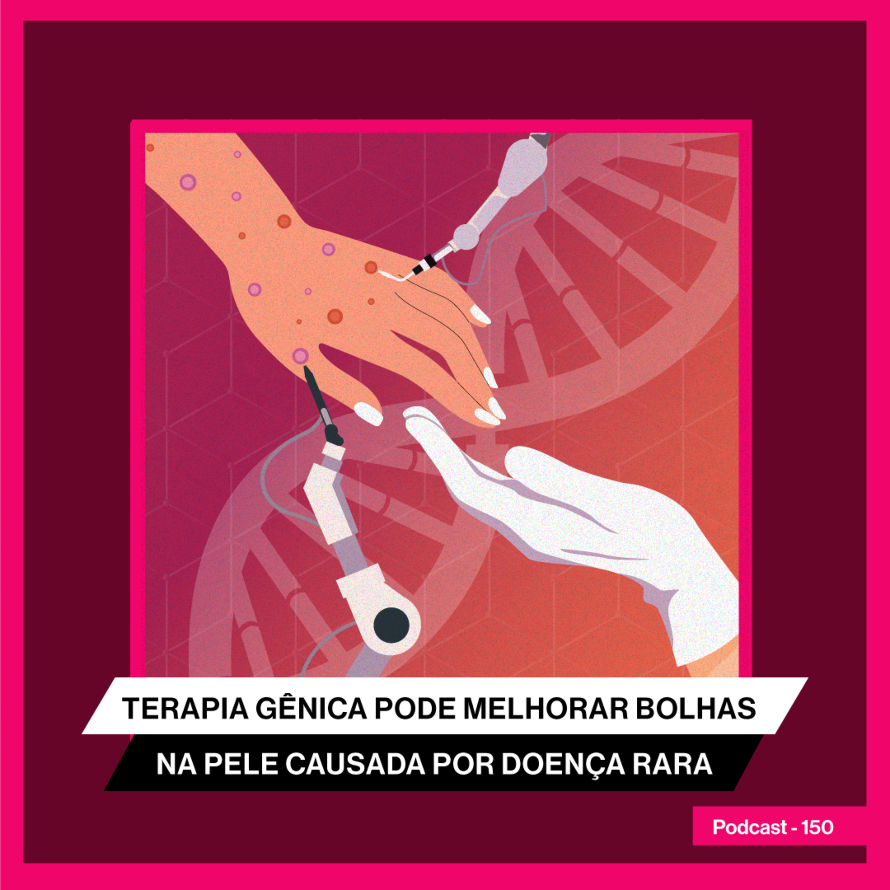 Terapia gênica pode melhorar bolhas na pele causadas por doença rara 