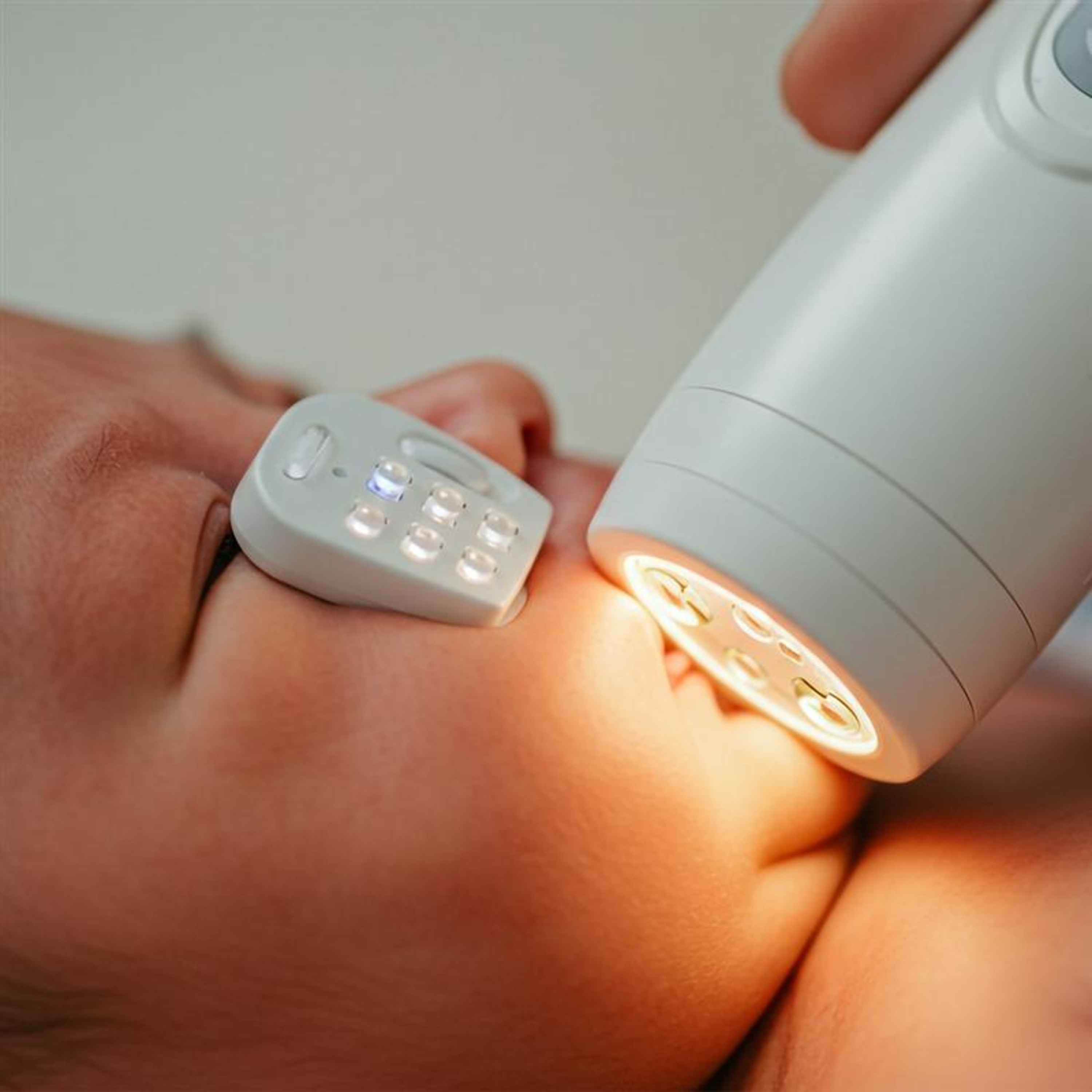 Triagem neonatal no Brasil: tecnologia, equidade e futuro