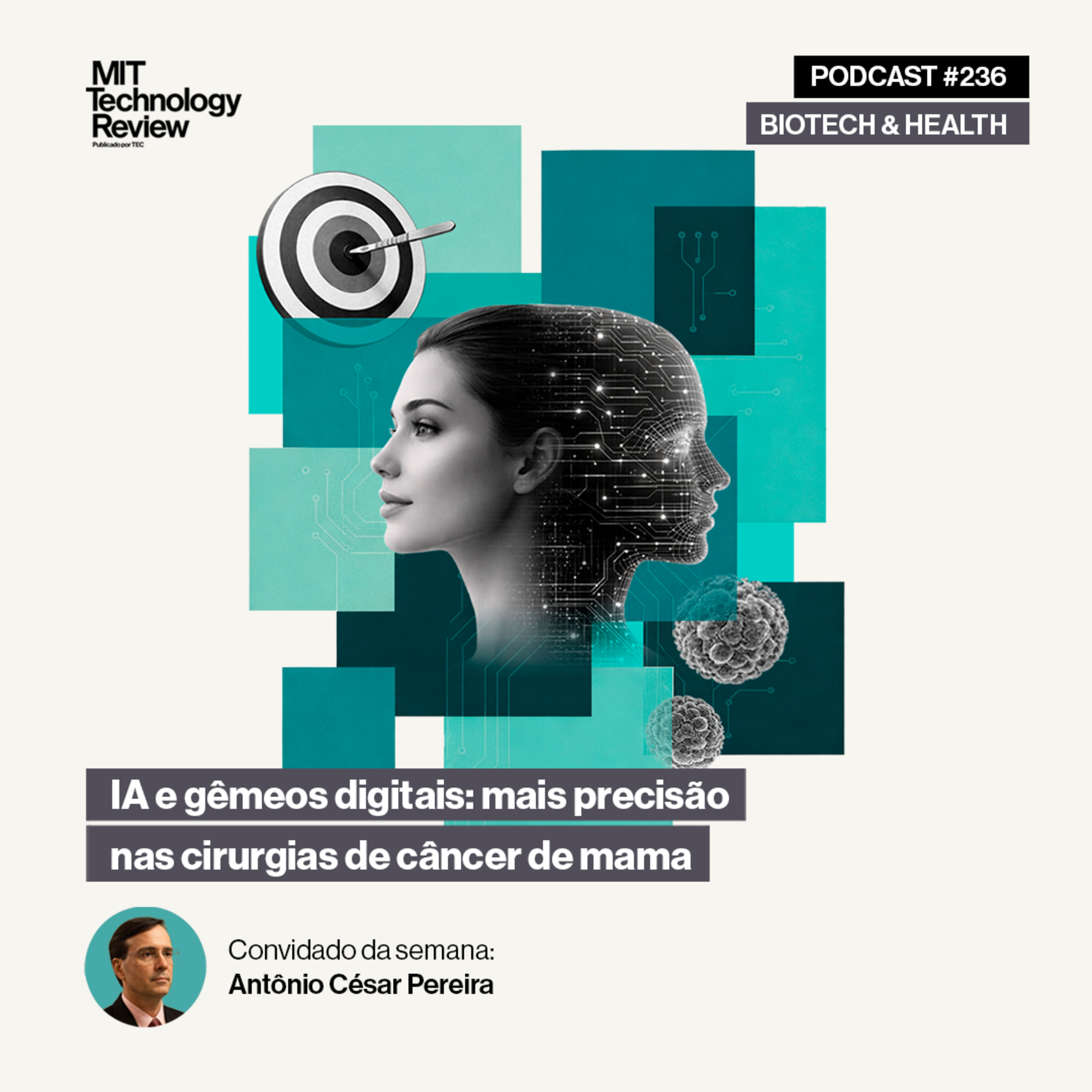 IA e gêmeos digitais: mais precisão nas cirurgias de câncer de mama 🧬🎯 #236