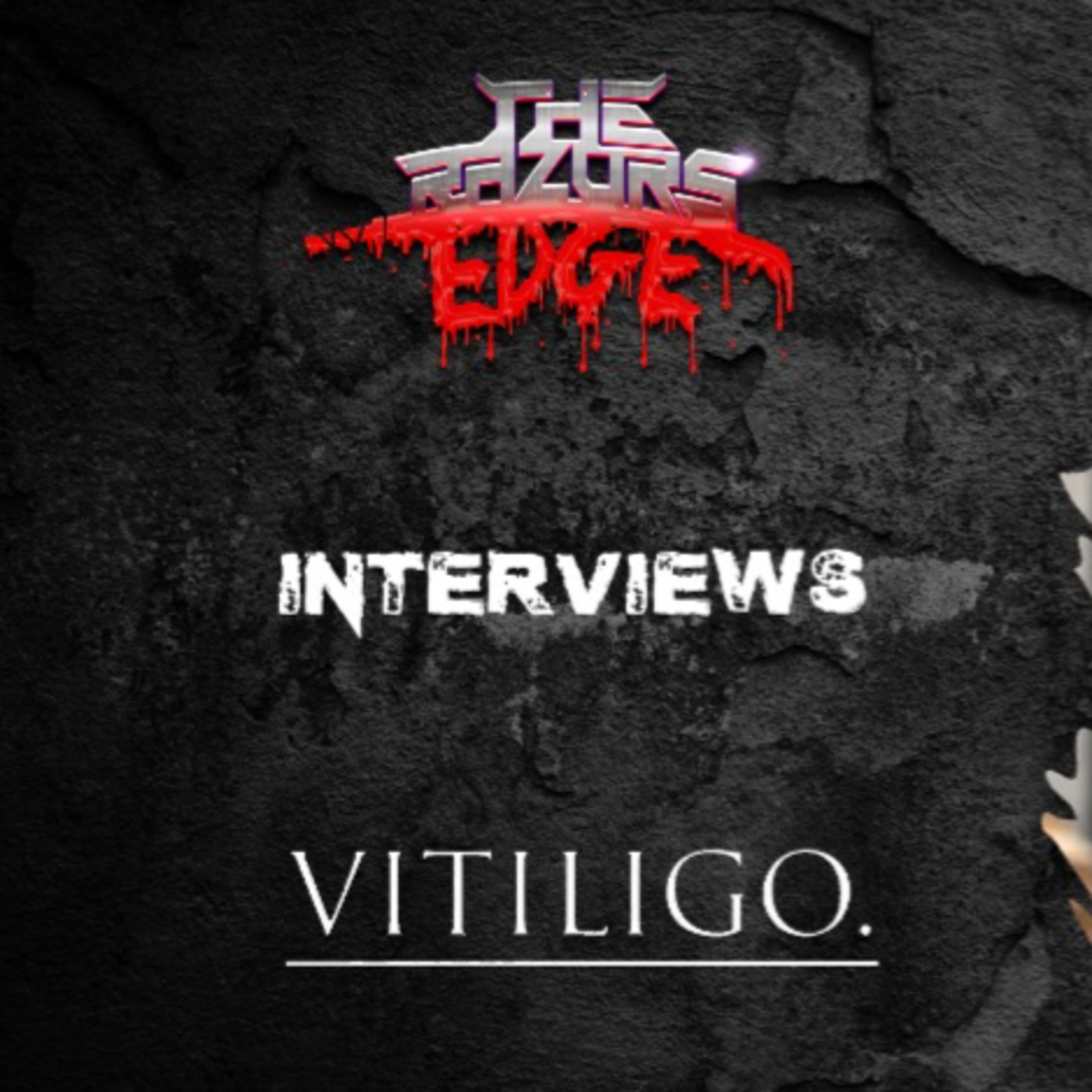 The Razor's Edge : Interview with Joel Henry Bulsara of Vitiligo