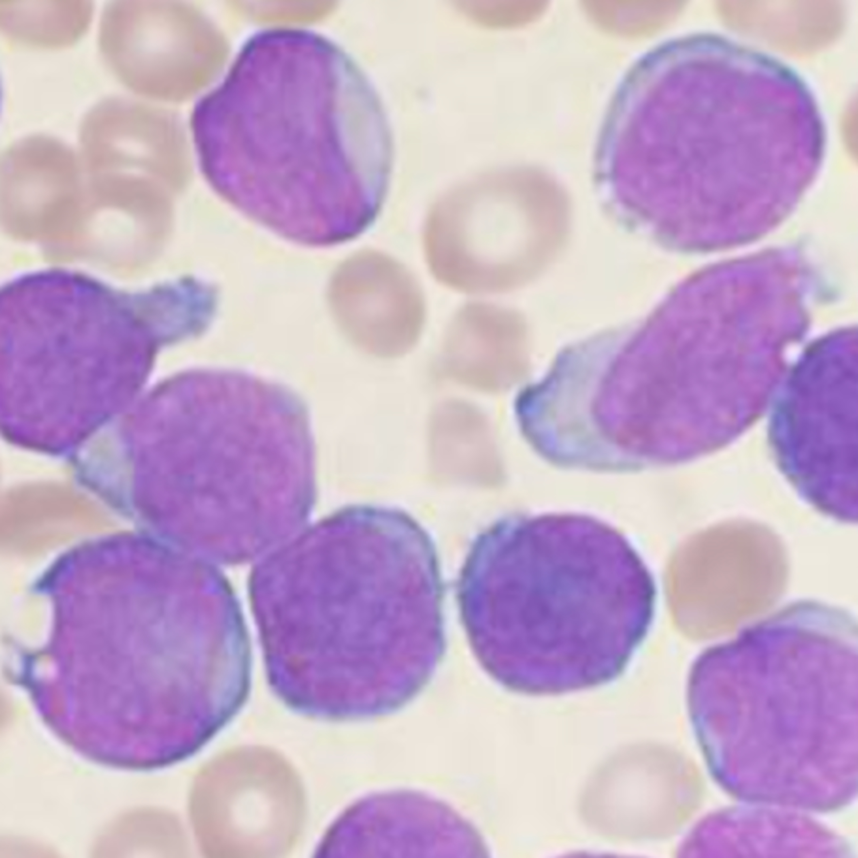 HY USMLE Q #739 – Heme
