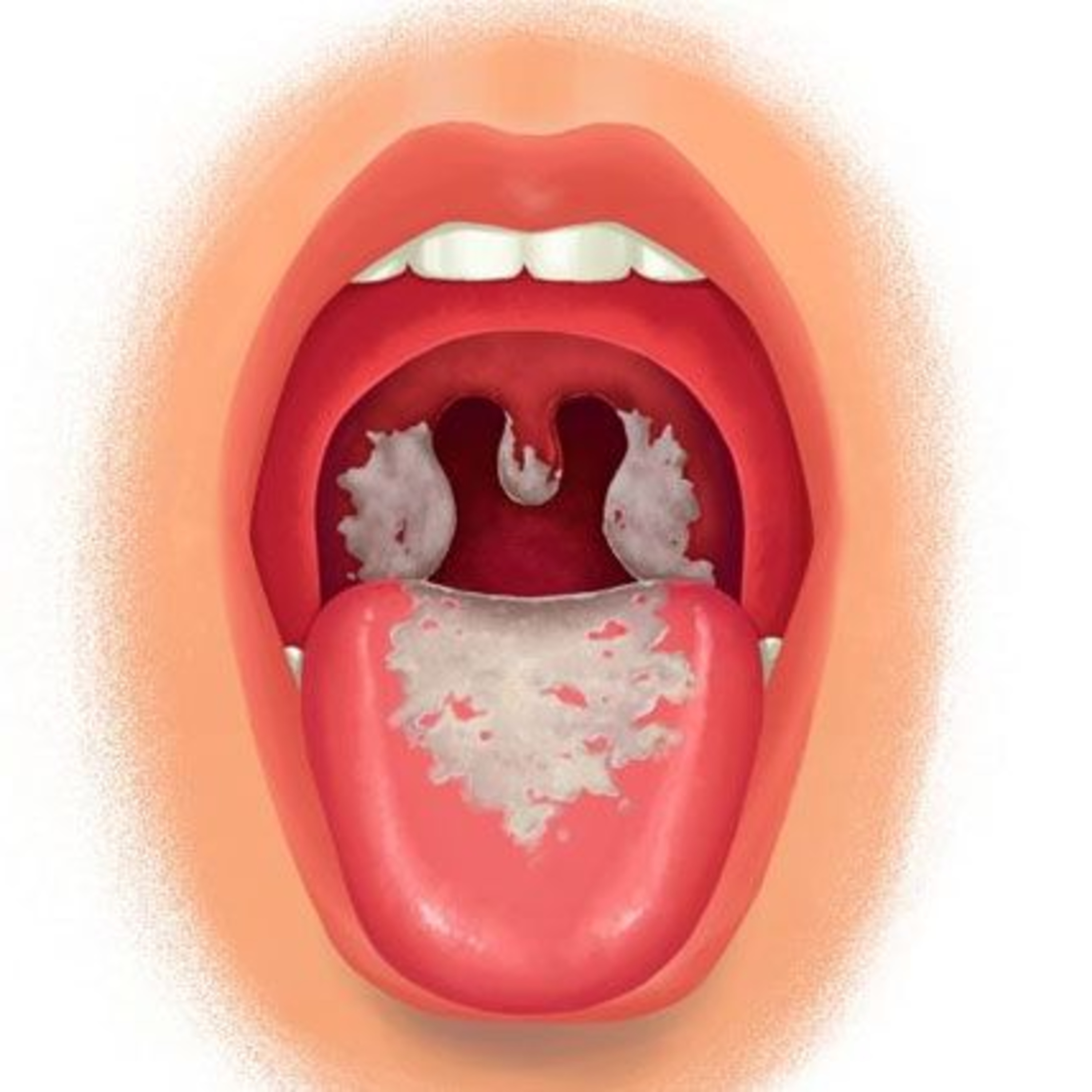 Đối thoại: TPHCM đủ vaccine bạch hầu để tiêm cho người dân có nhu cầu episode artwork