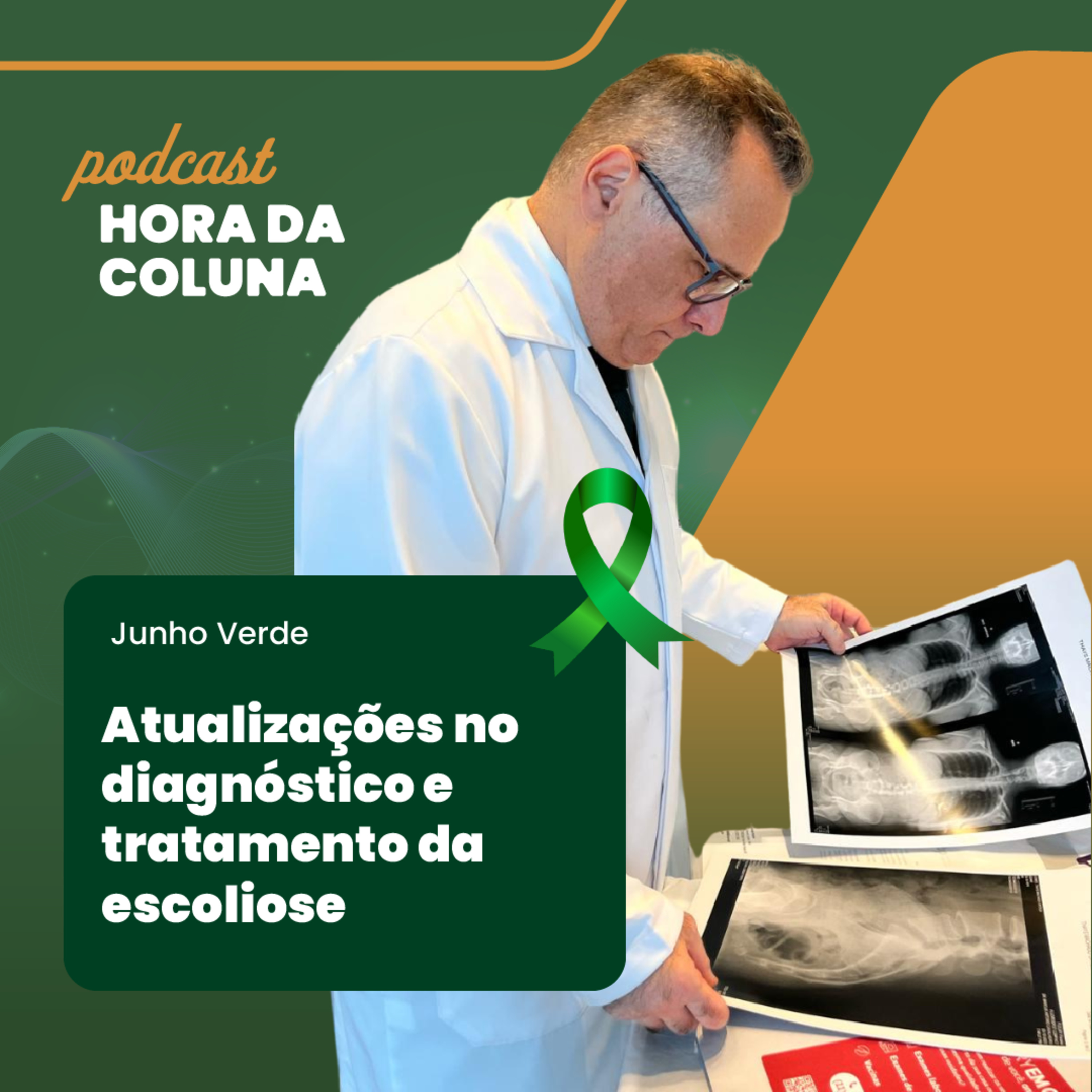 #19 Atualizações no diagnóstico e tratamento da escoliose episode artwork