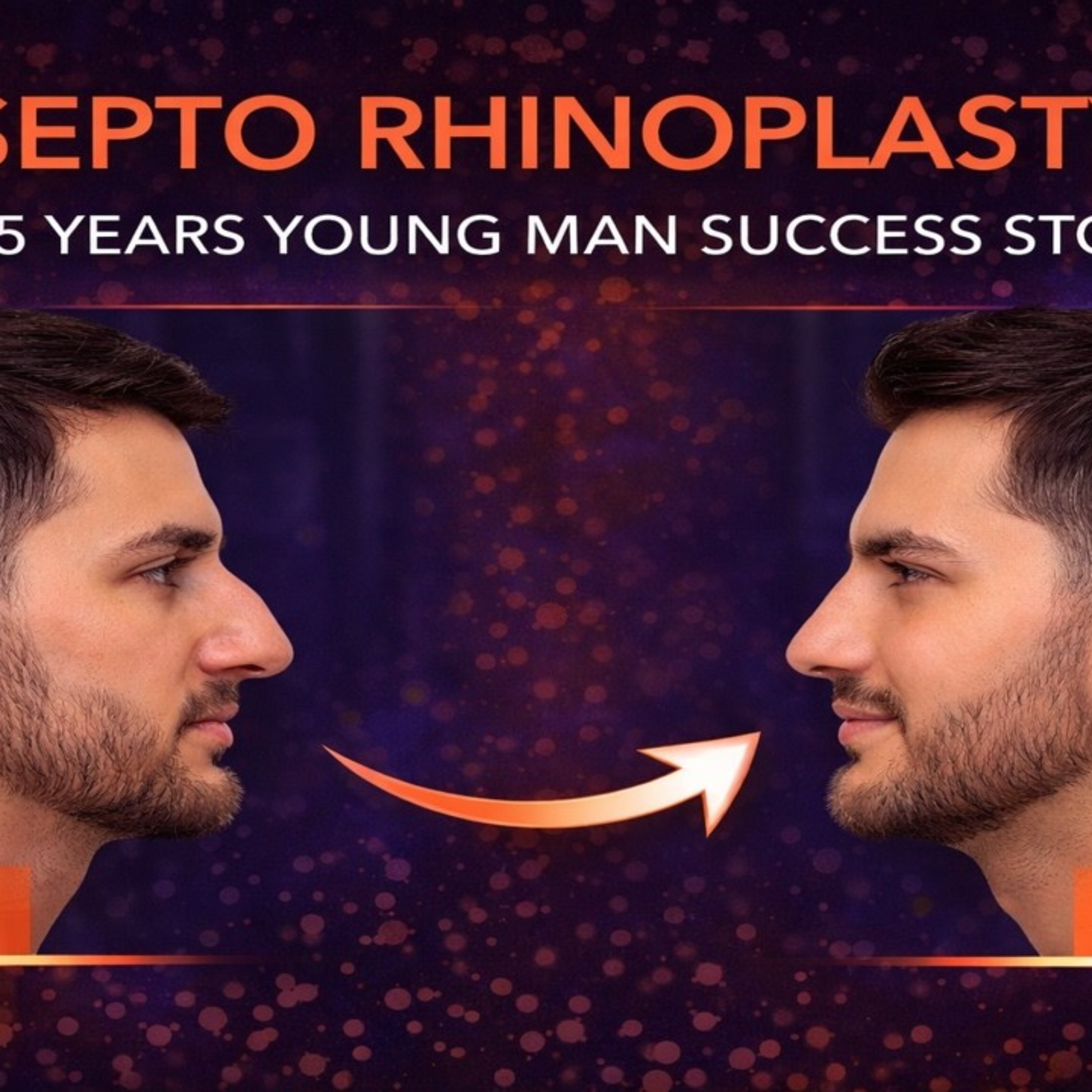Septorhinoplasty Transformation | 25-Year-Old Man’s Nose Surgery Success Story episode artwork
