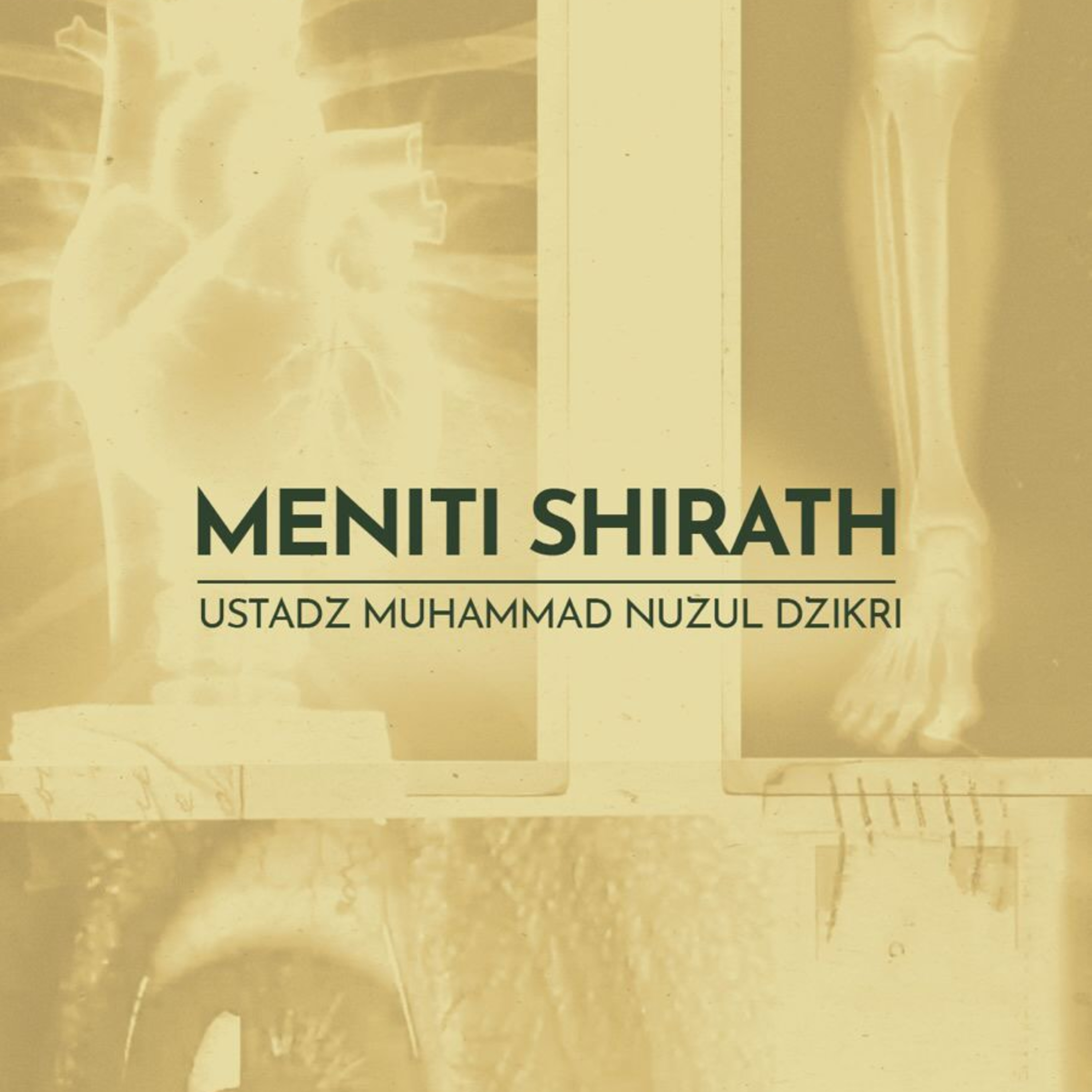 Meniti Shirath (Crossing the Shirath)