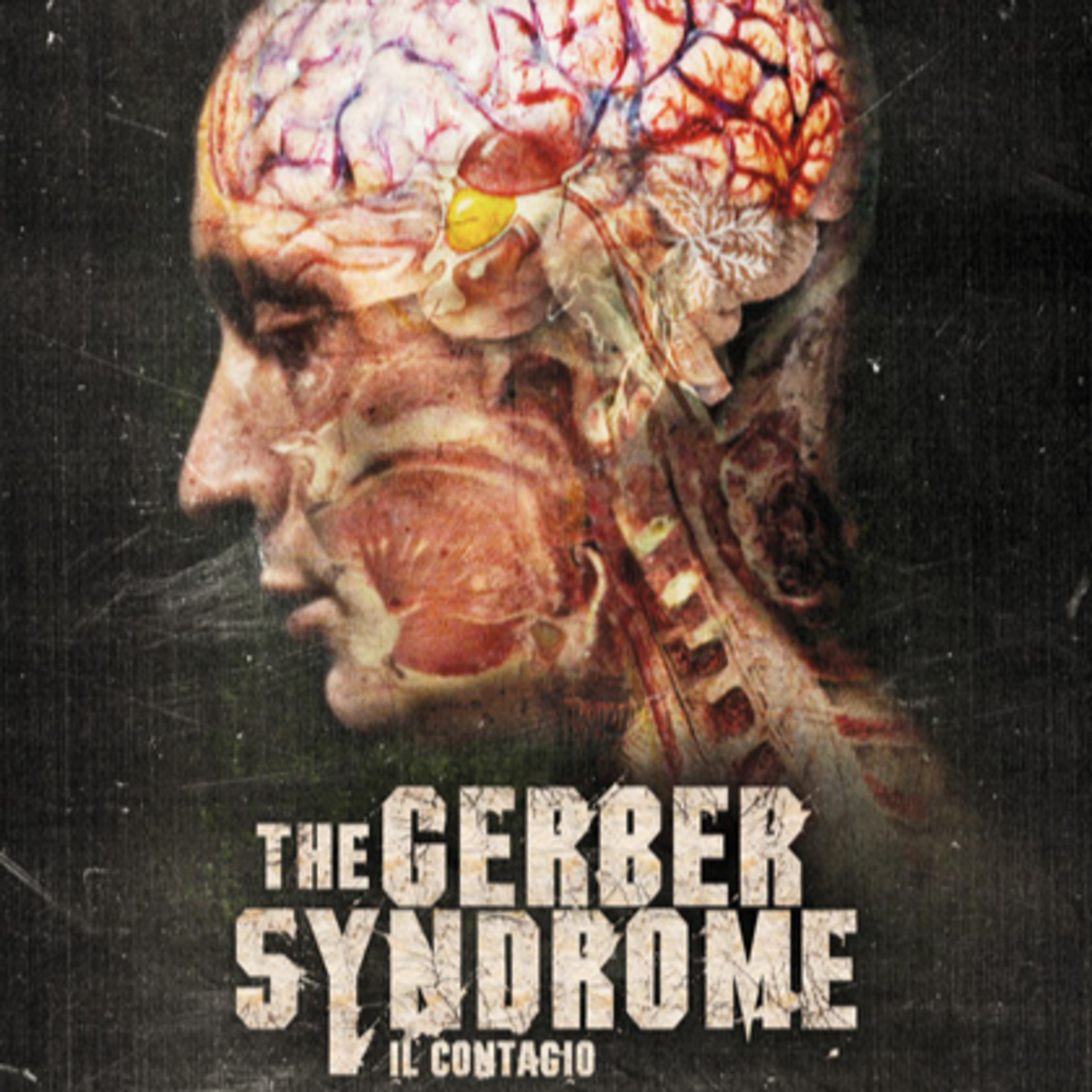 Recensioni CaRfatiche - The Gerber Syndrome: il contagio (Maxi Dejoie 2011) episode artwork