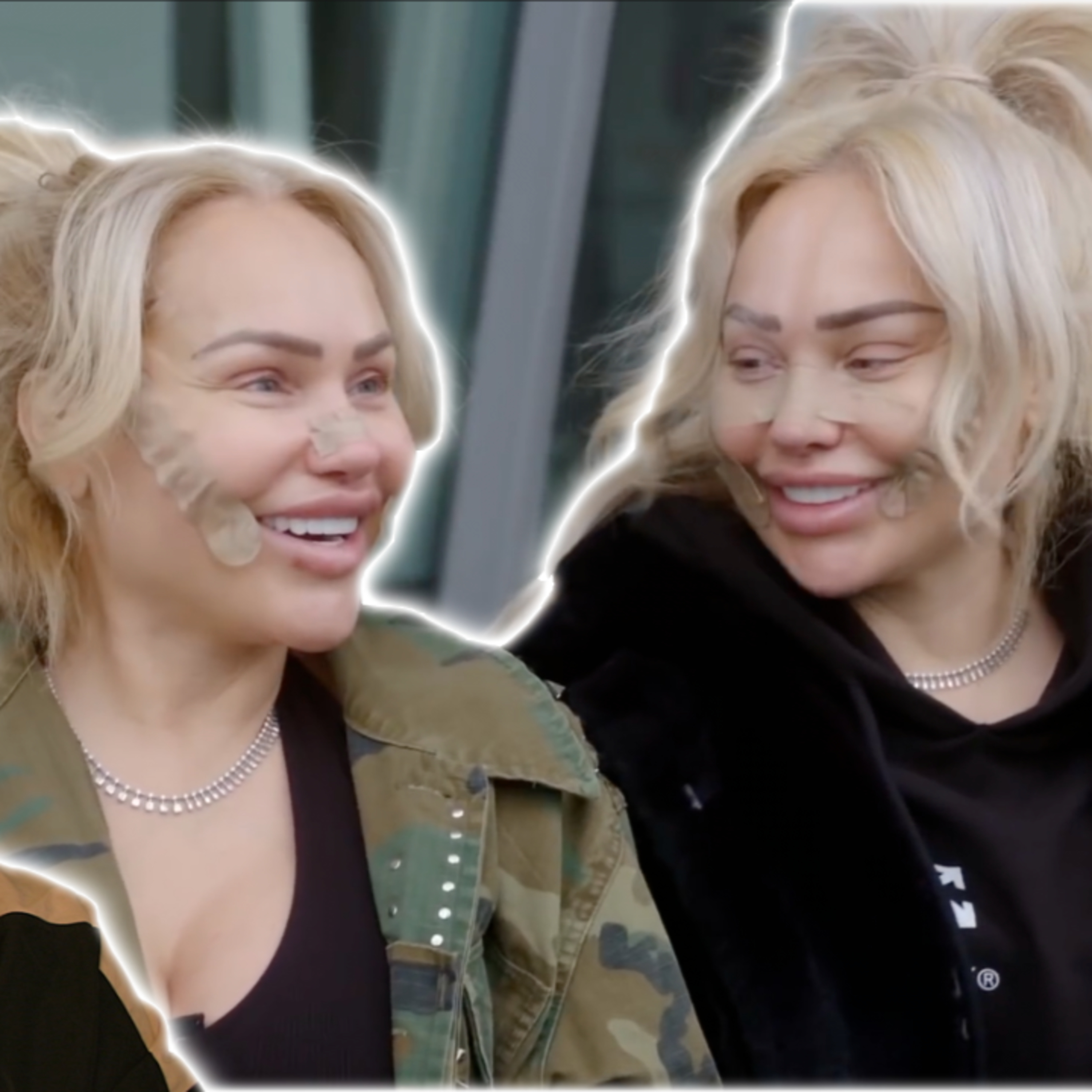Darcey And Stacey Post Surgery