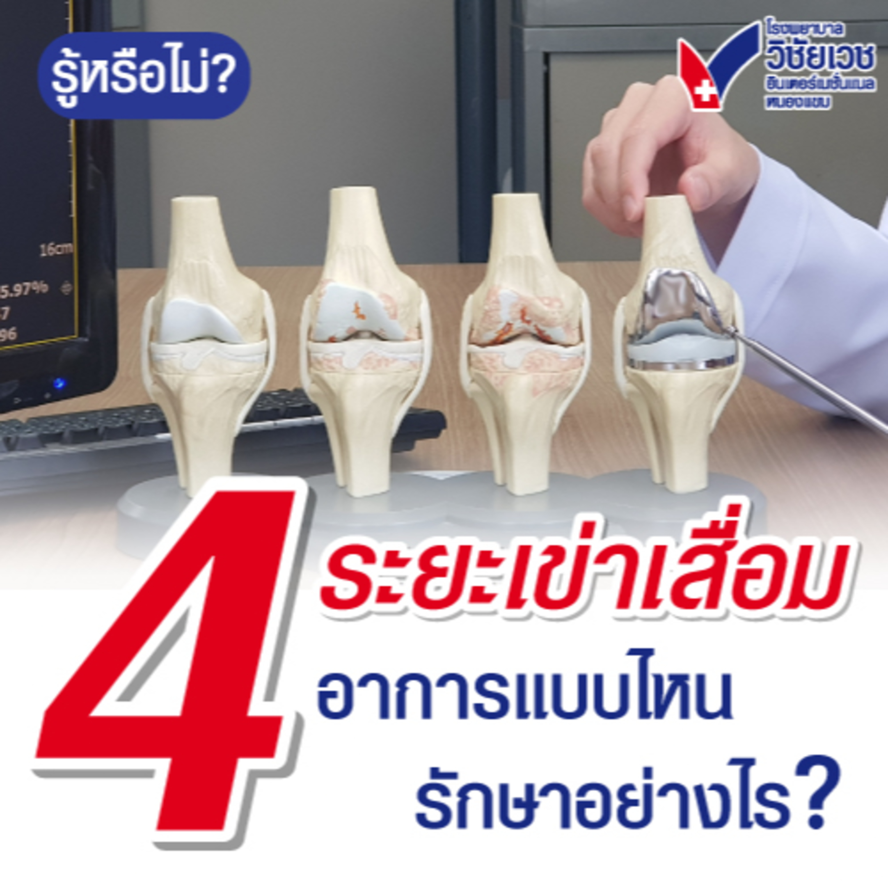 4 ระยะเข่าเสื่อม อาการแบบไหน? รักษาอย่างไร? episode artwork