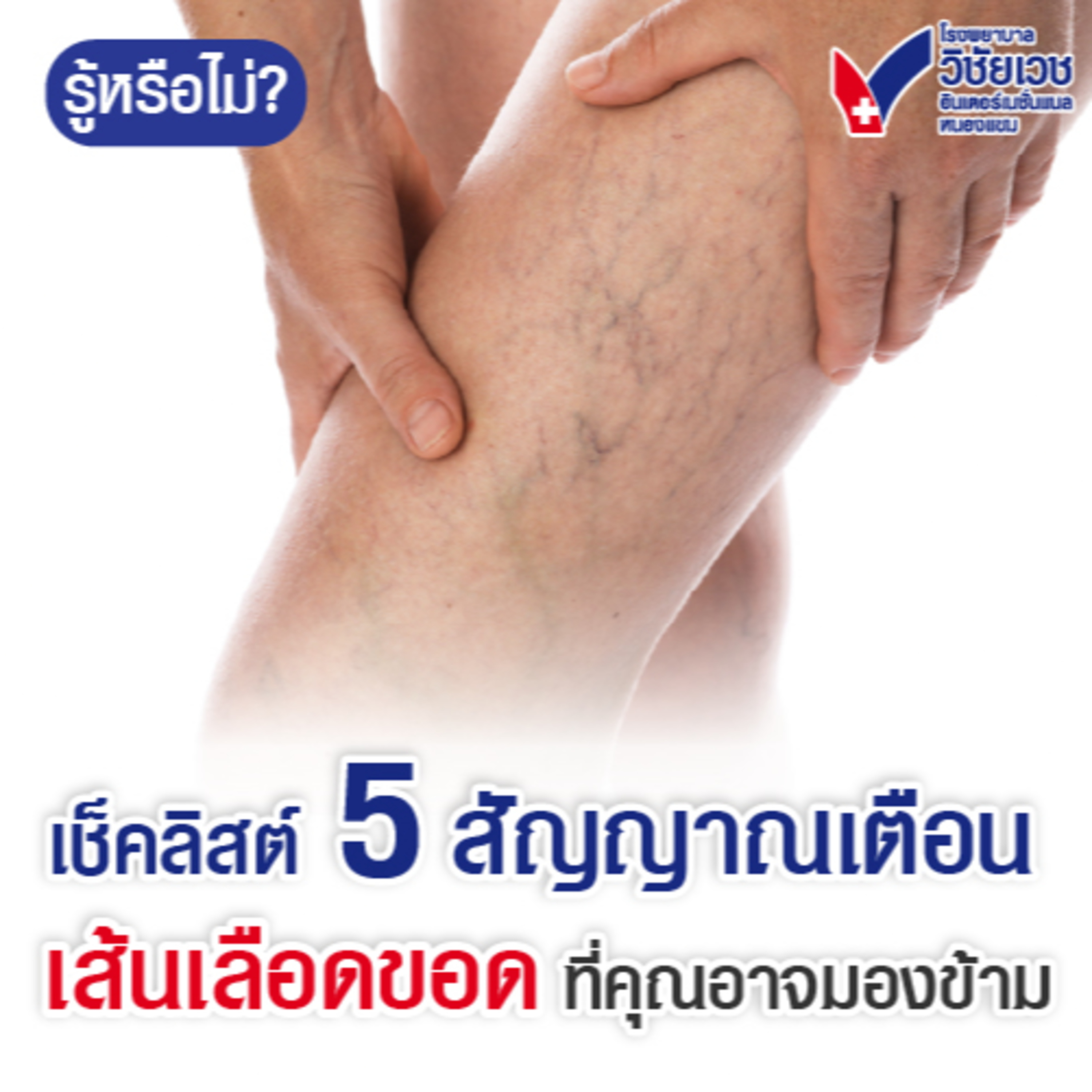 เช็คลิสต์ 5 สัญญาณเตือนเส้นเลือดขอด ที่ที่ 