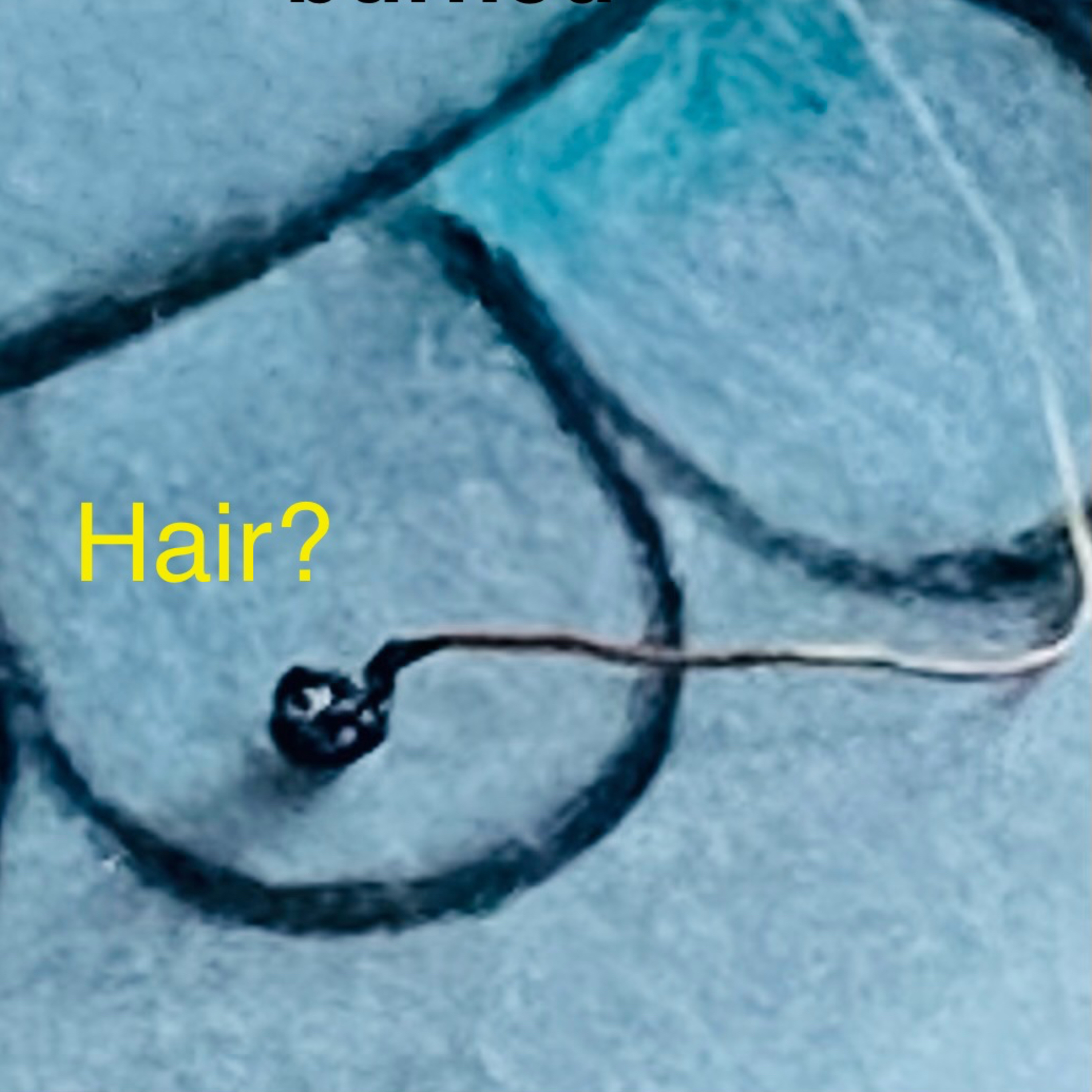 Morgellons Transducers
