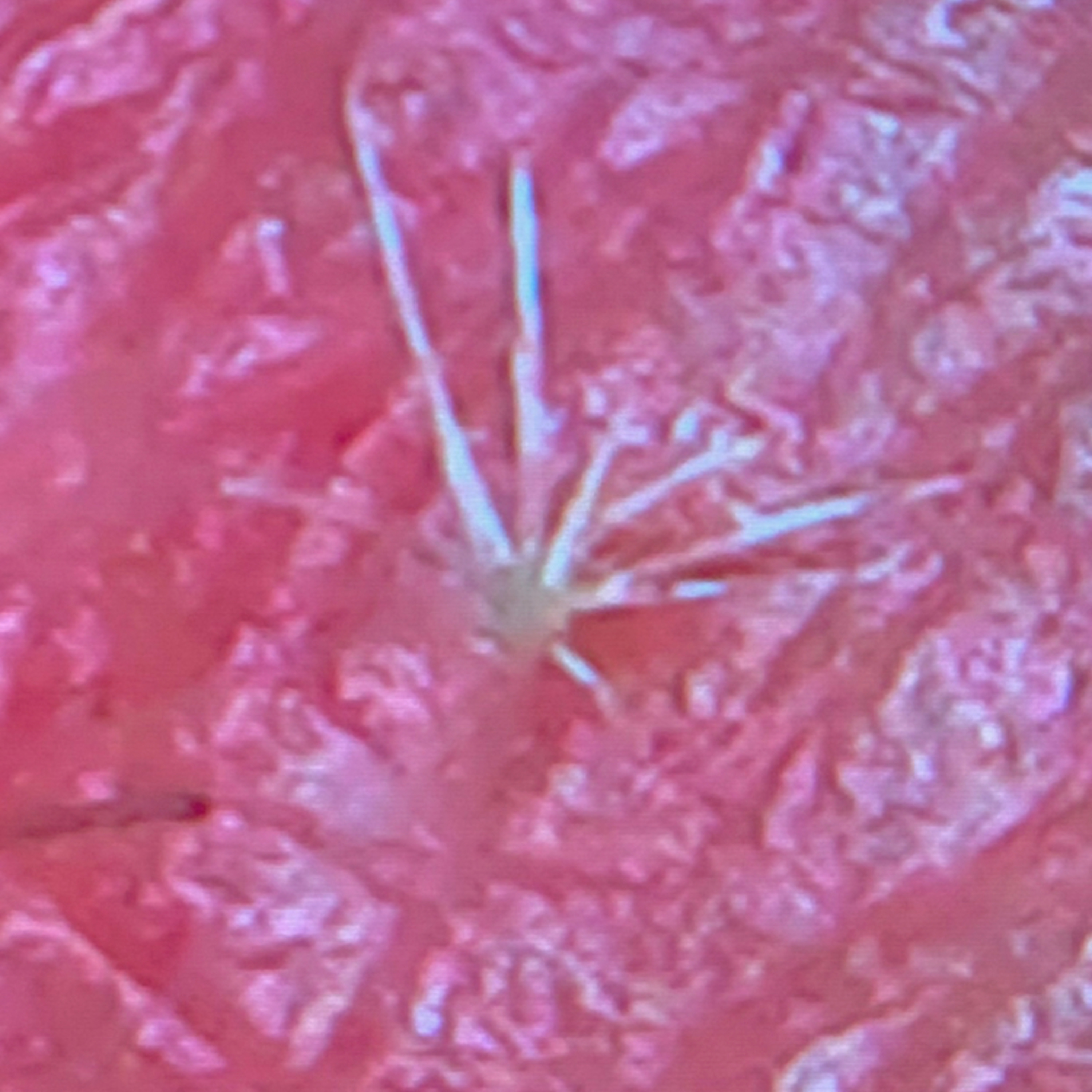 Morgellons in New Zealand