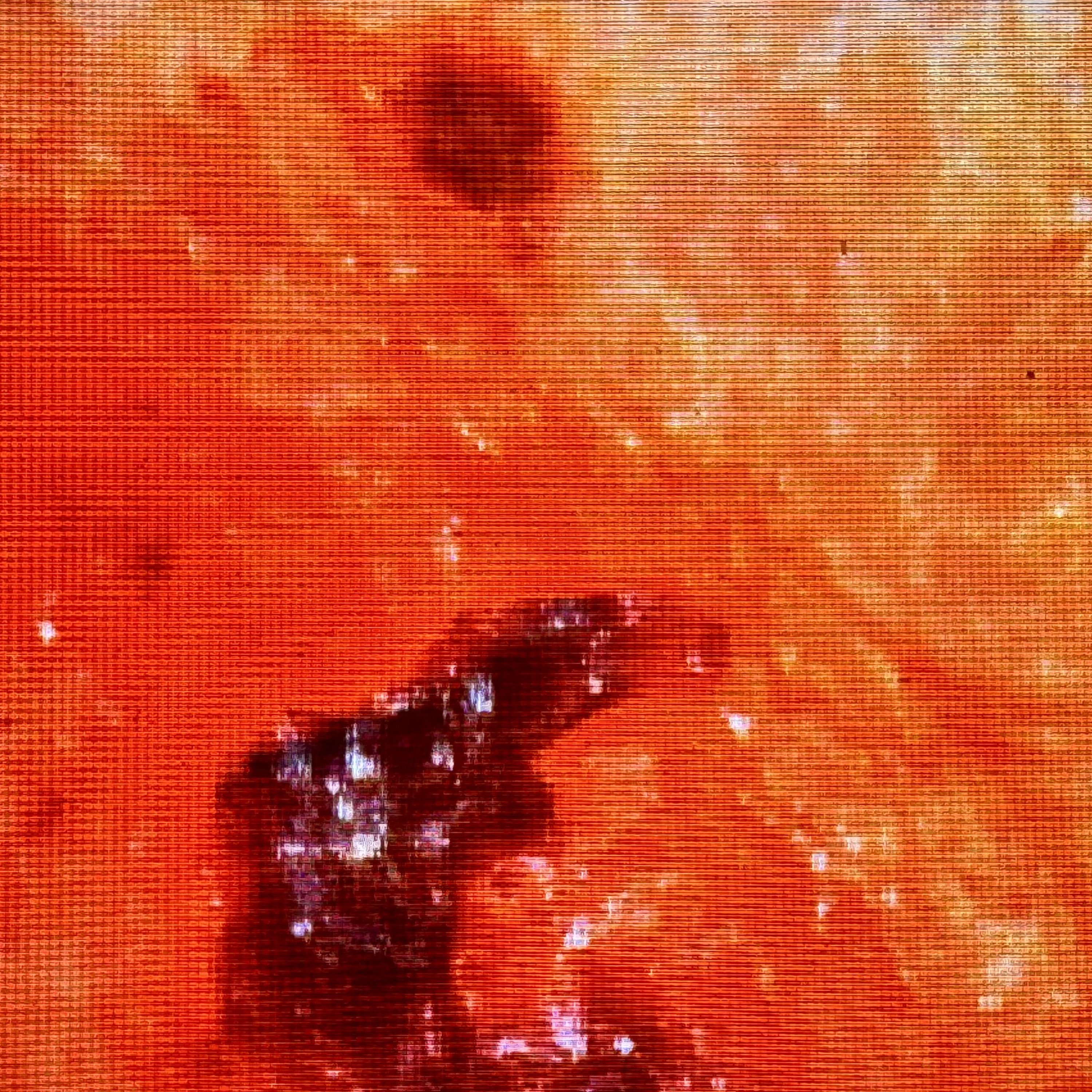 Morgellons Biopsy
