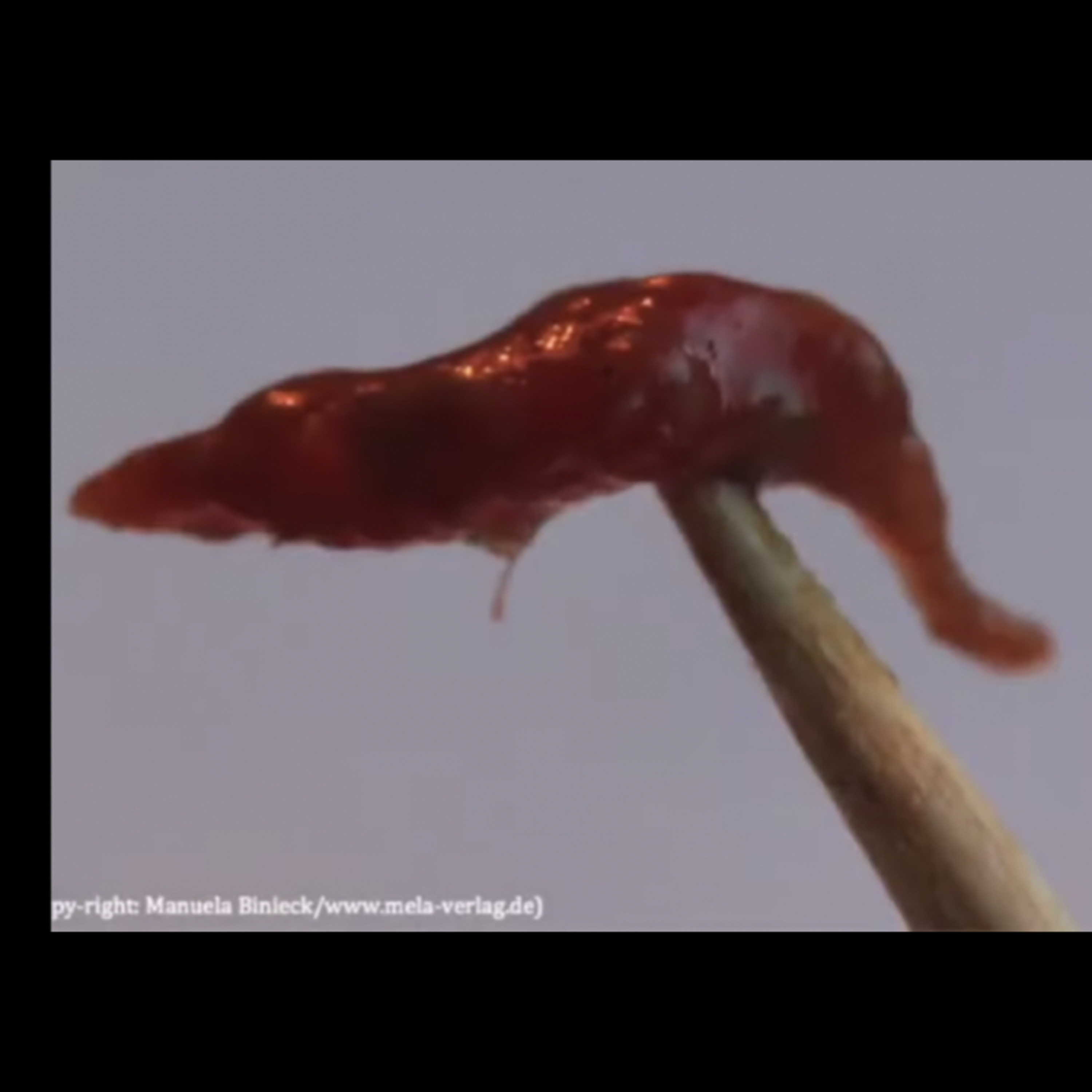 Phenytoin for BDD Morgellons  episode artwork