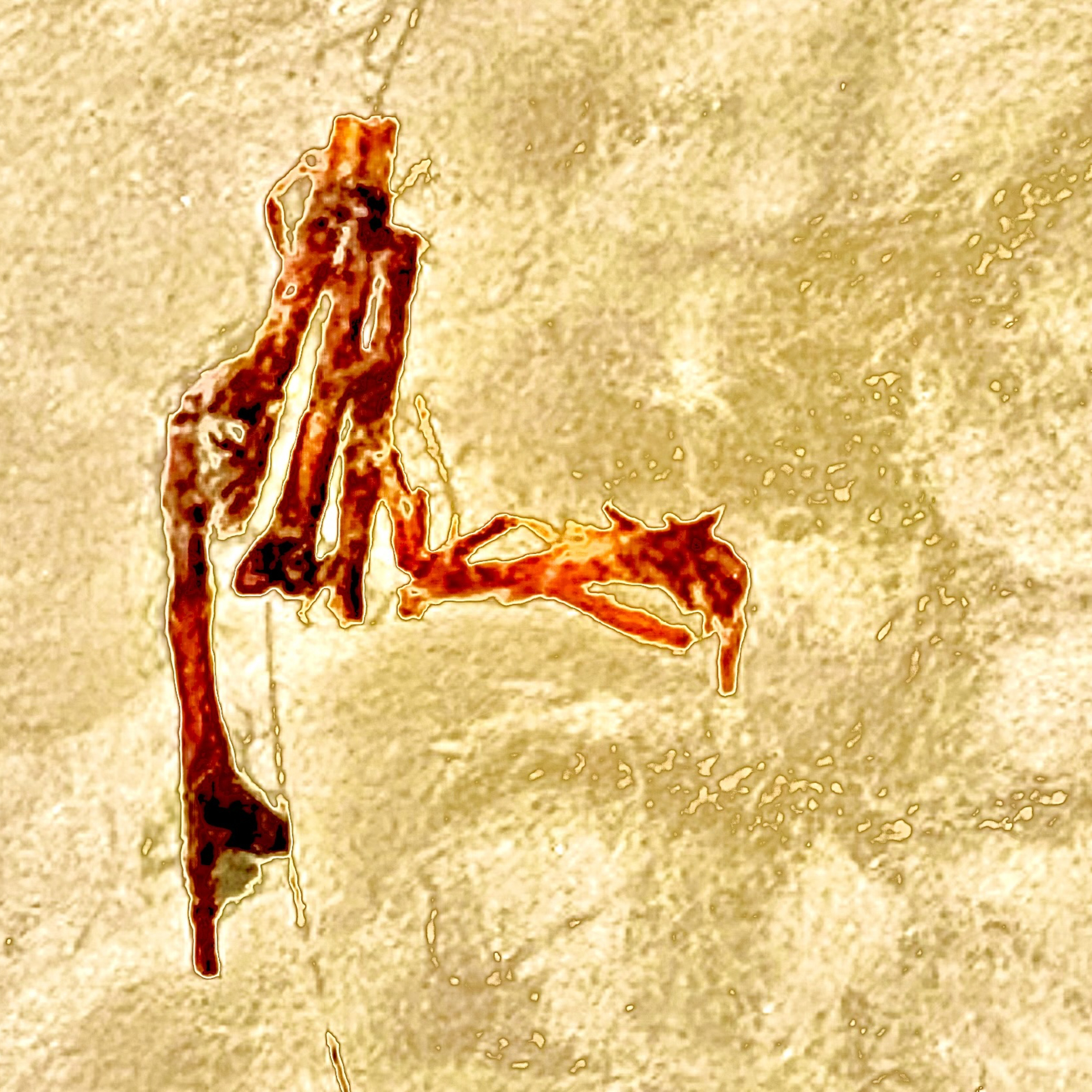 Infectious pseudochromhidrosis episode artwork