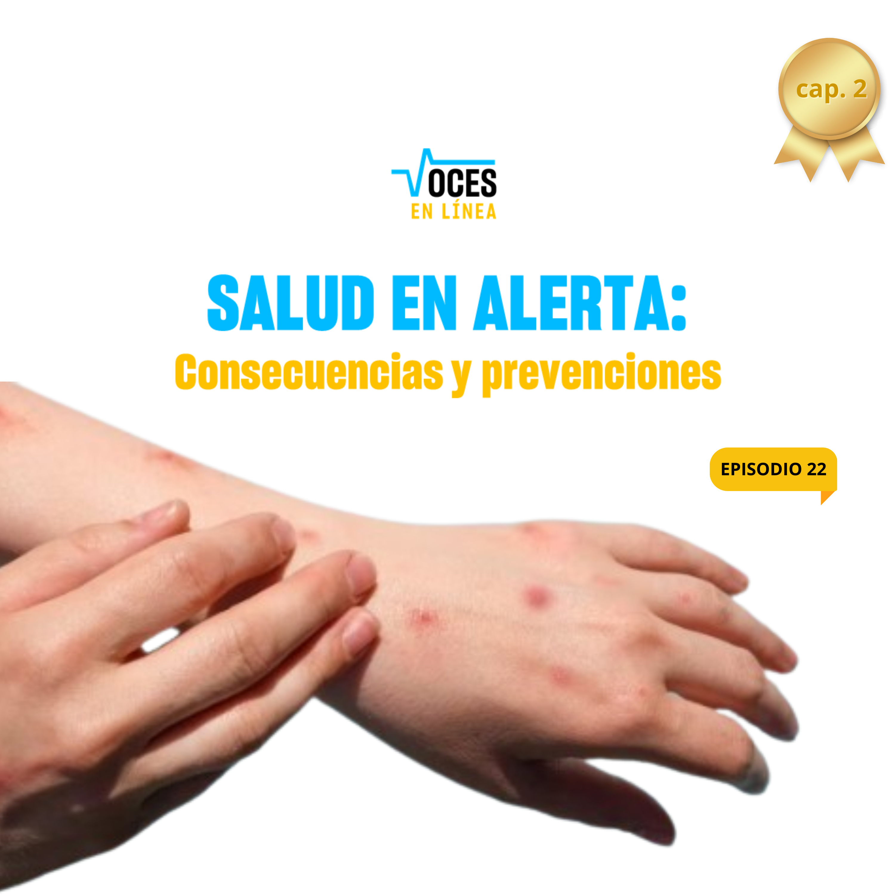 🚨 SALUD EN ALERTA (cap. 2): Consecuencias y Prevenciones de la Viruela del mono🚨- VOCES EN LÍNEA - RADIO UPN episode artwork