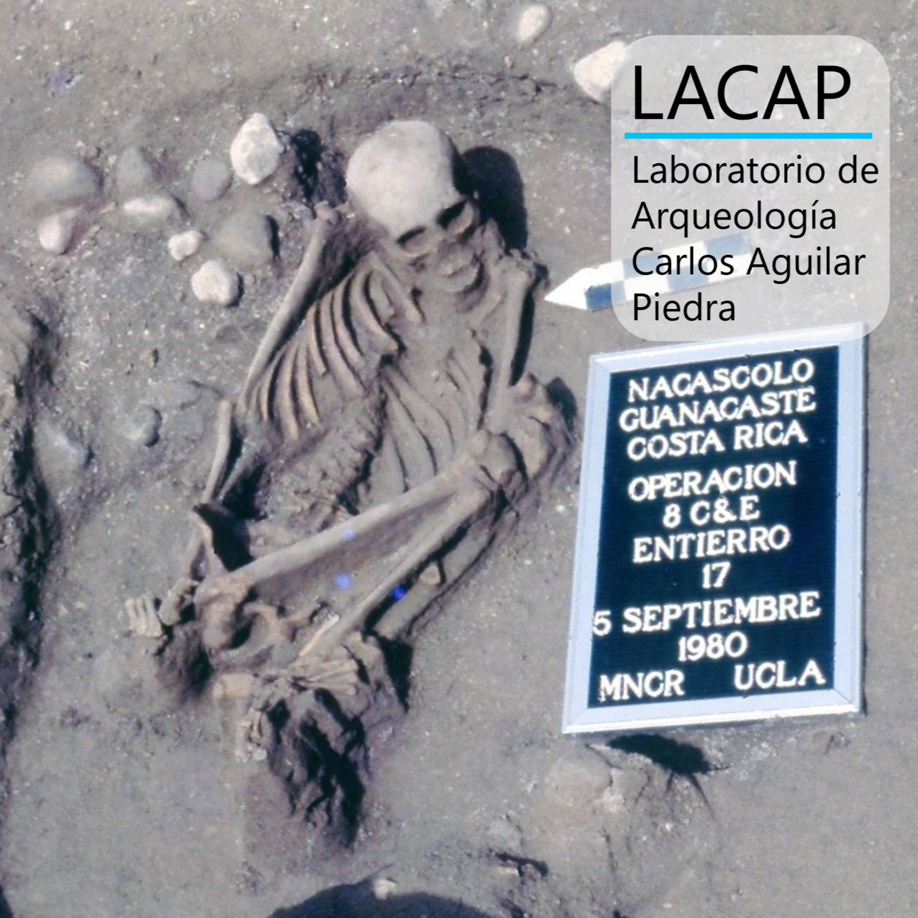 LACAP