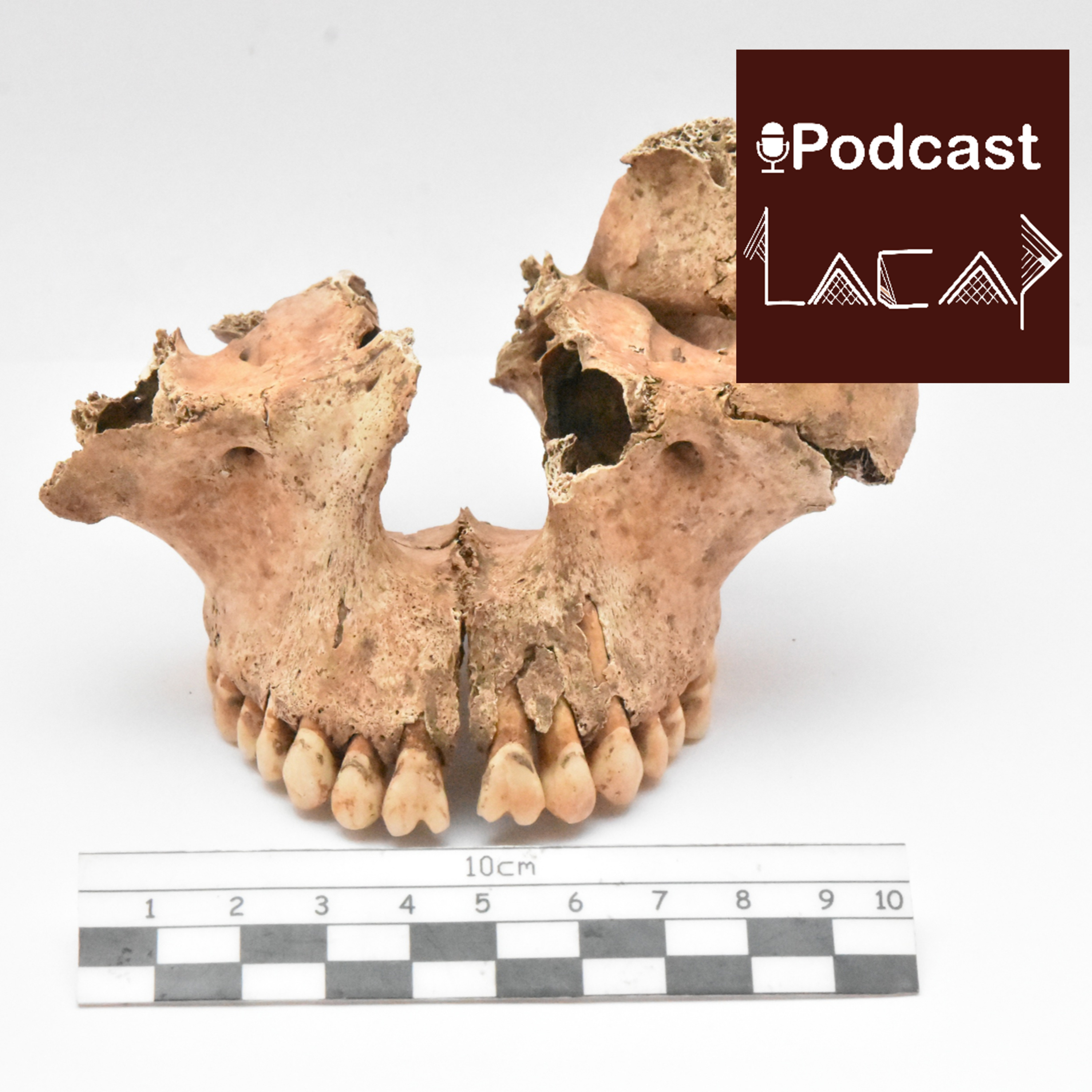 Portada de Podcast LACAP
