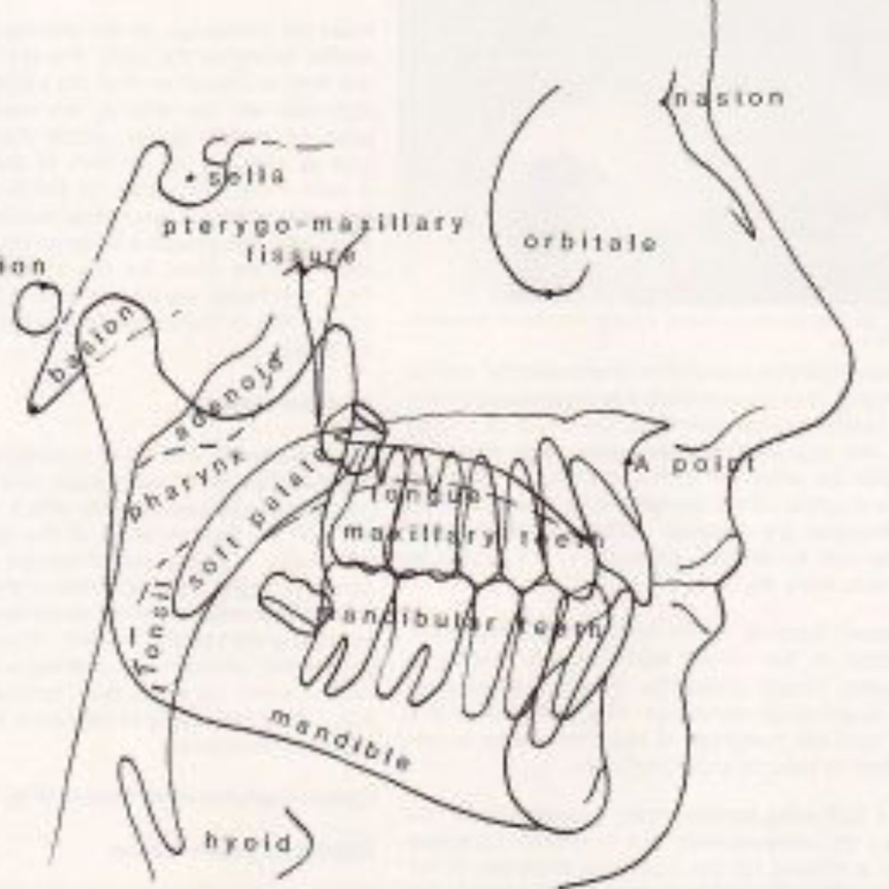 📝 “What is the Wits Analysis in Orthognathic Surgery Planning?” episode artwork
