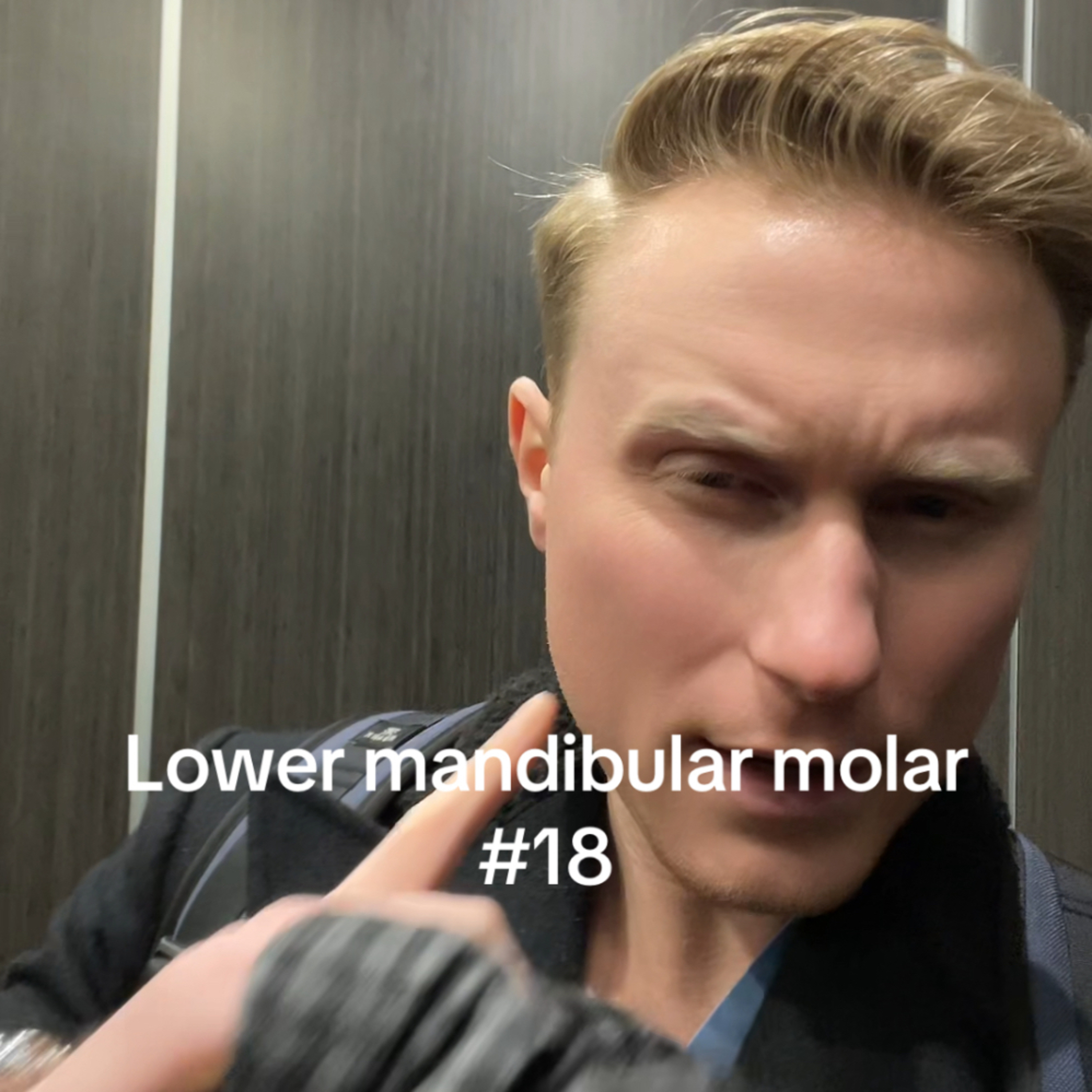 🎥 Tooth Ankylosis After Root Canals - Residency Day 1267