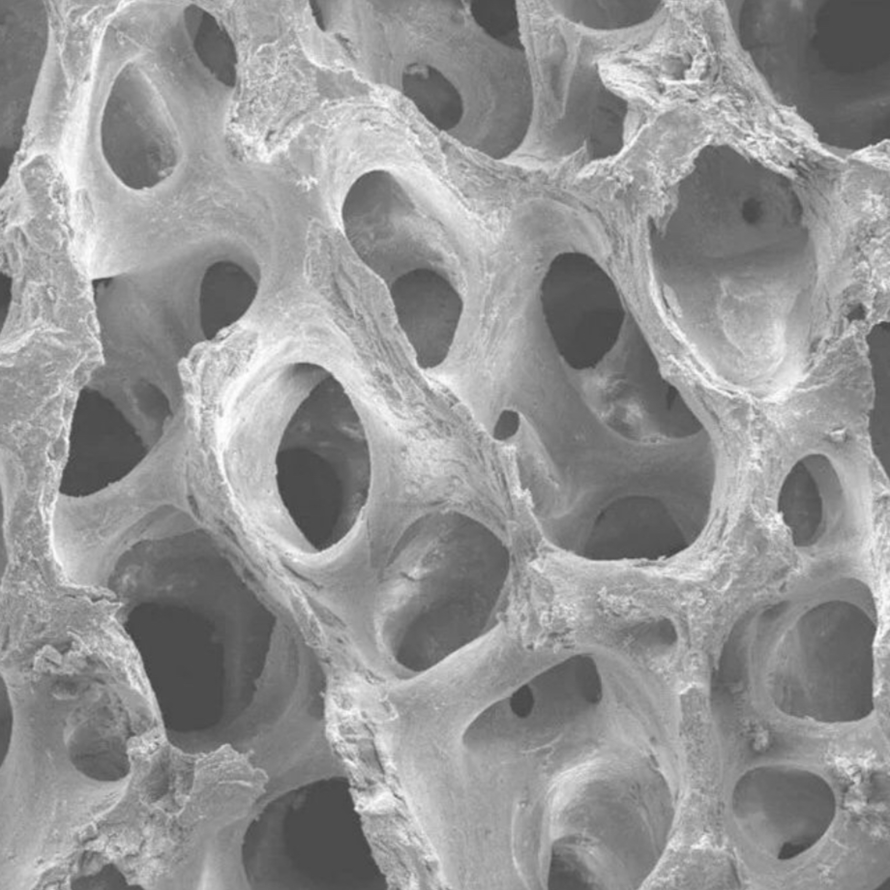 📝 “What are the Differences Between Demineralized & Mineralized Bone Grafts?”