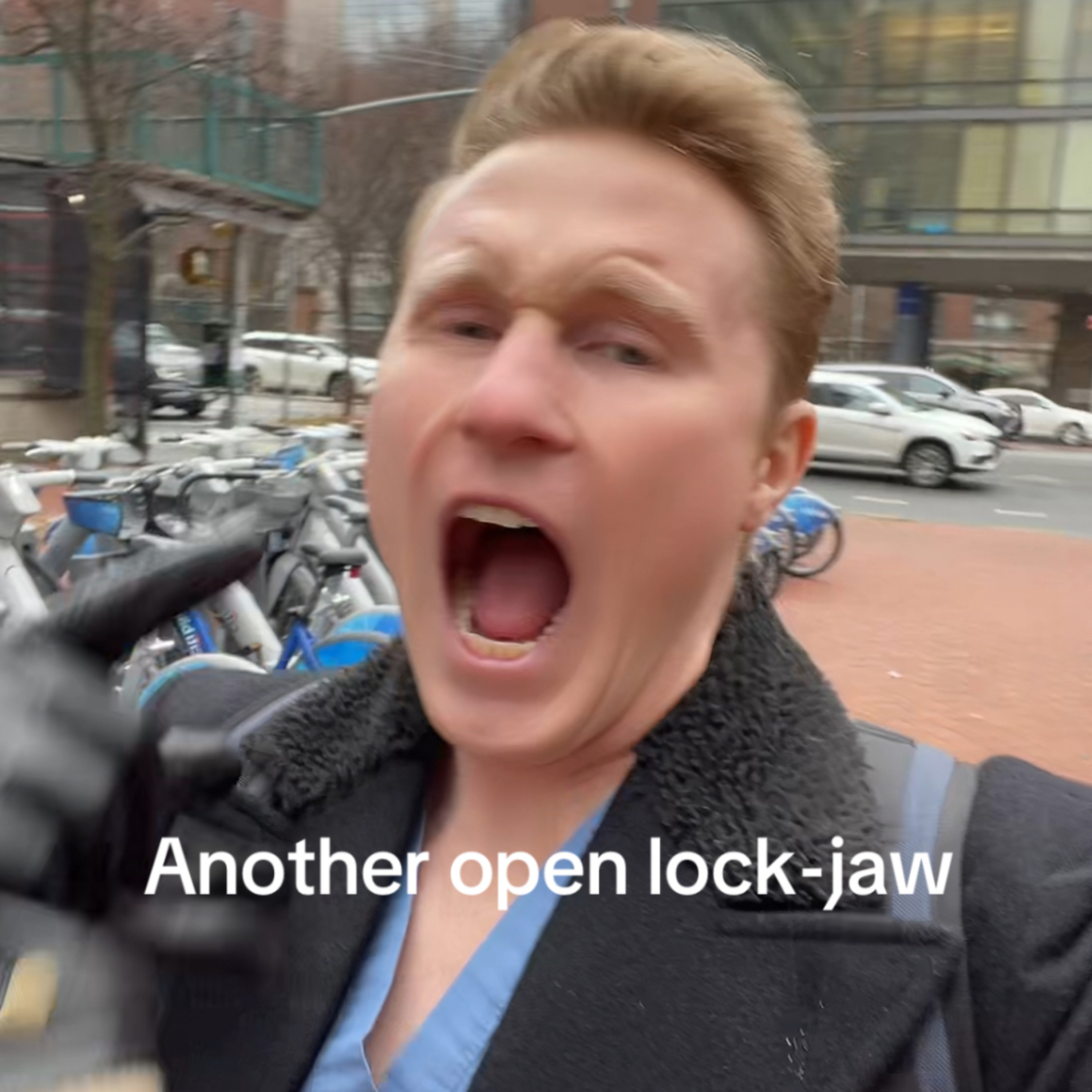 🎥 Open Lock Jaw - Residency Day 1302