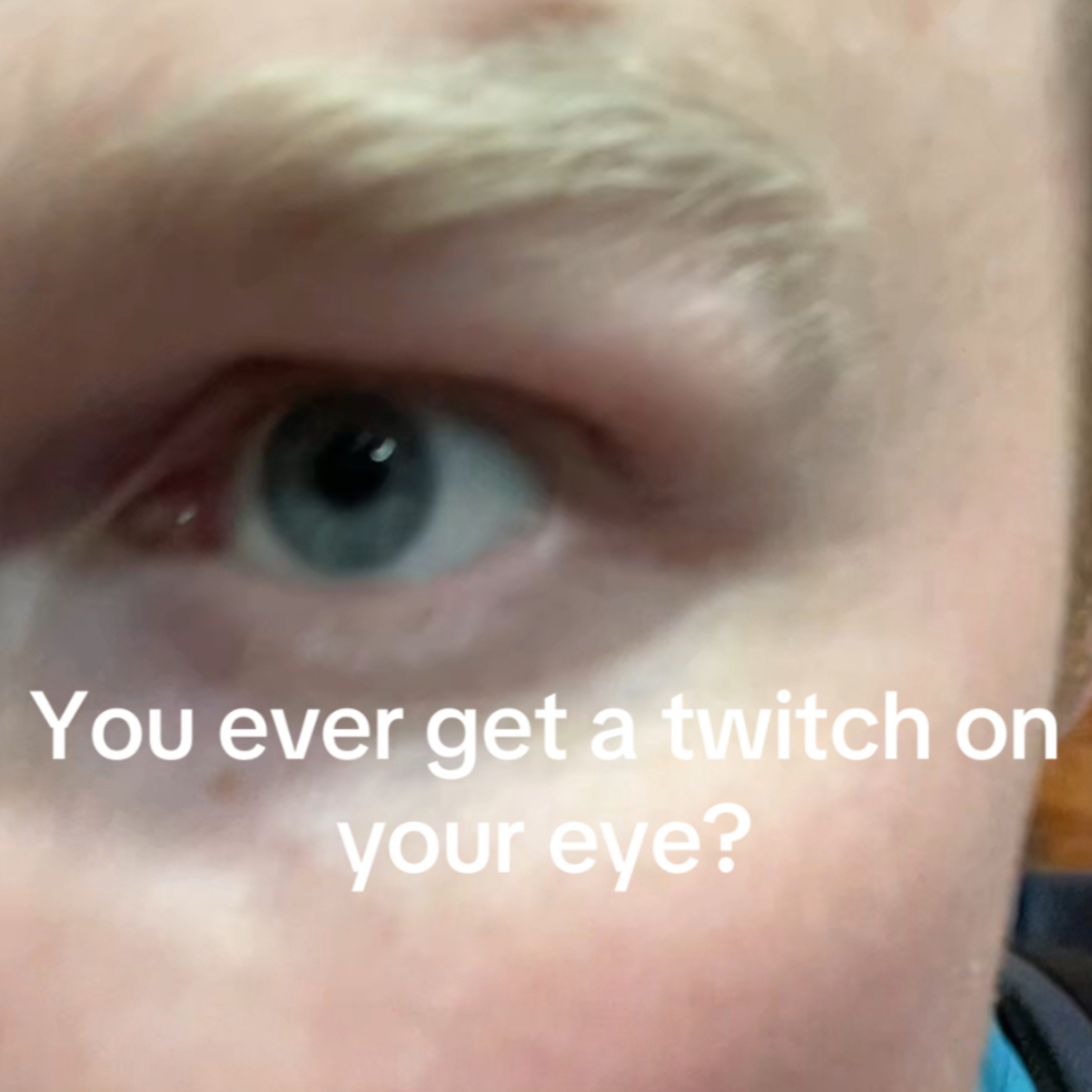 🎥 Eye Twitch - Residency Day 1340