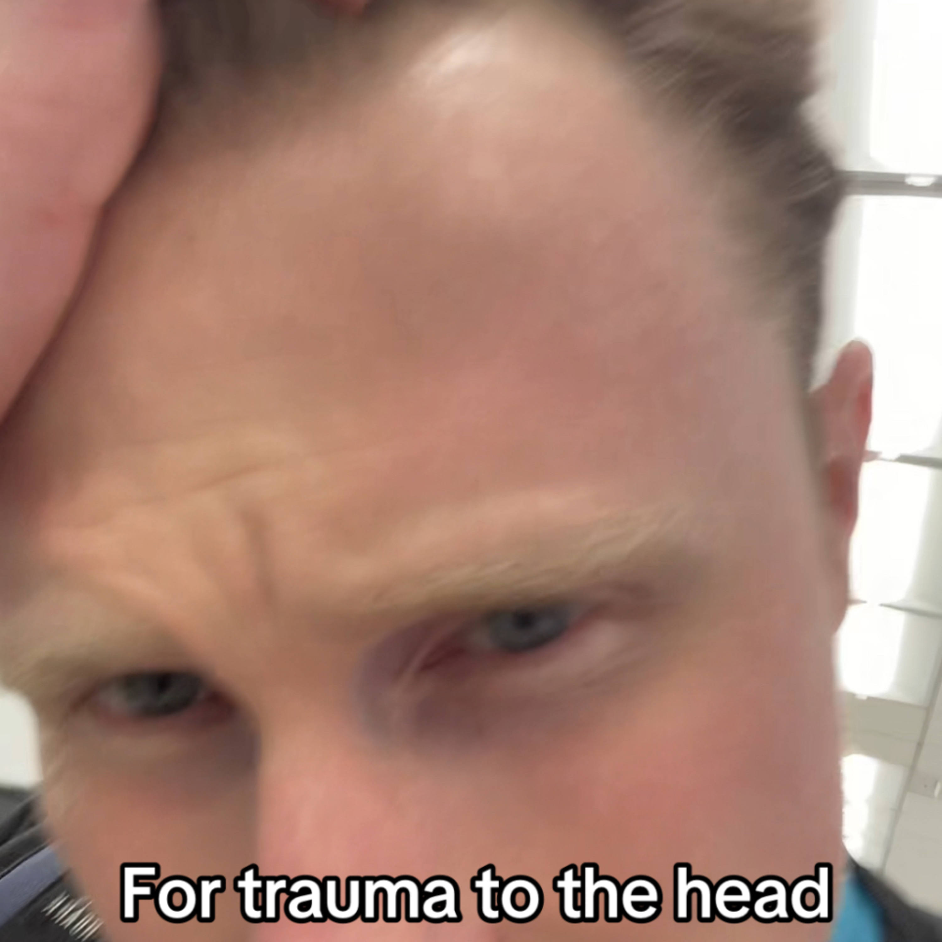 🎥 1 Week Before Residency Started - Residency Day 1412