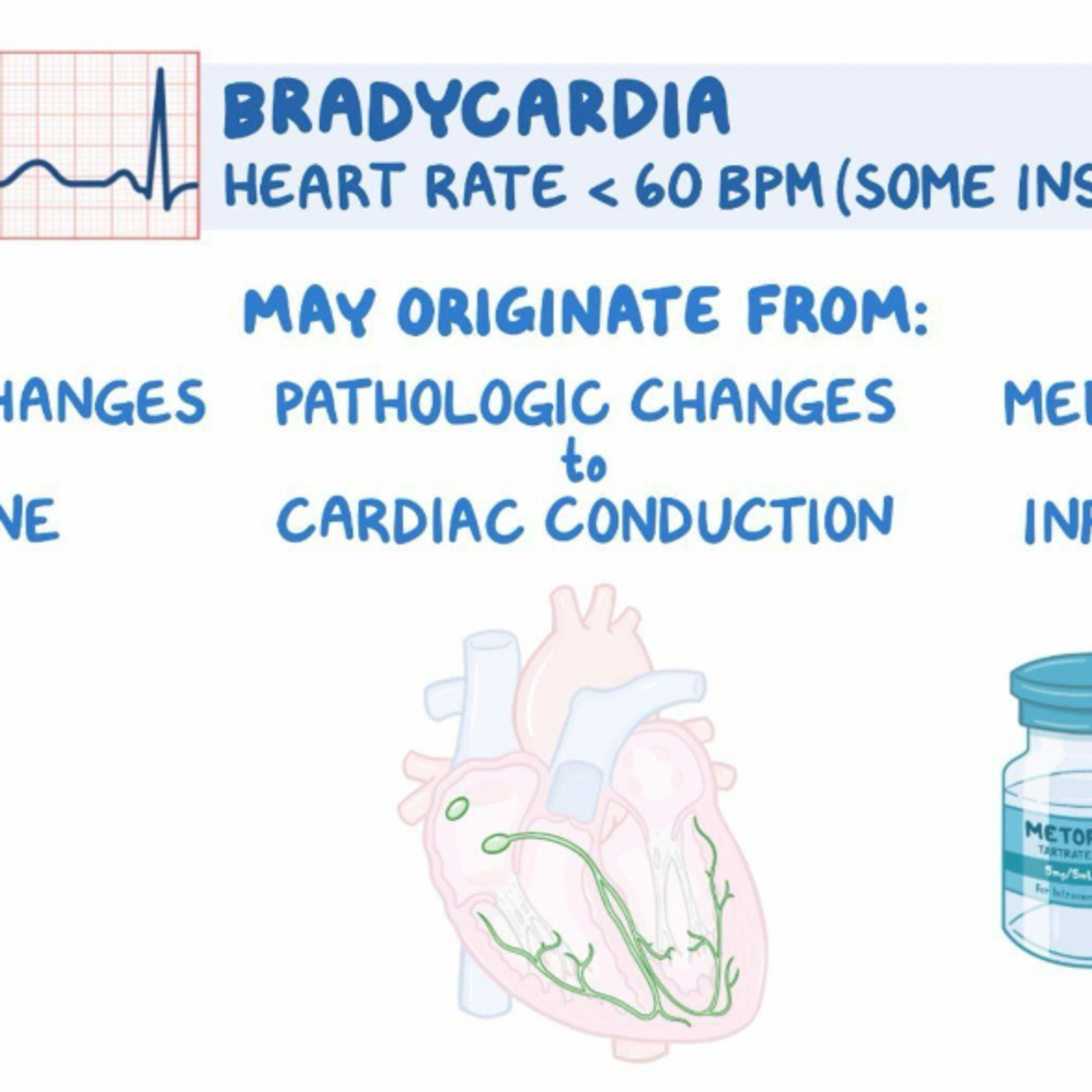 📝 “How Do You Manage Bradycardia With Hypotension in IV Sedation?”