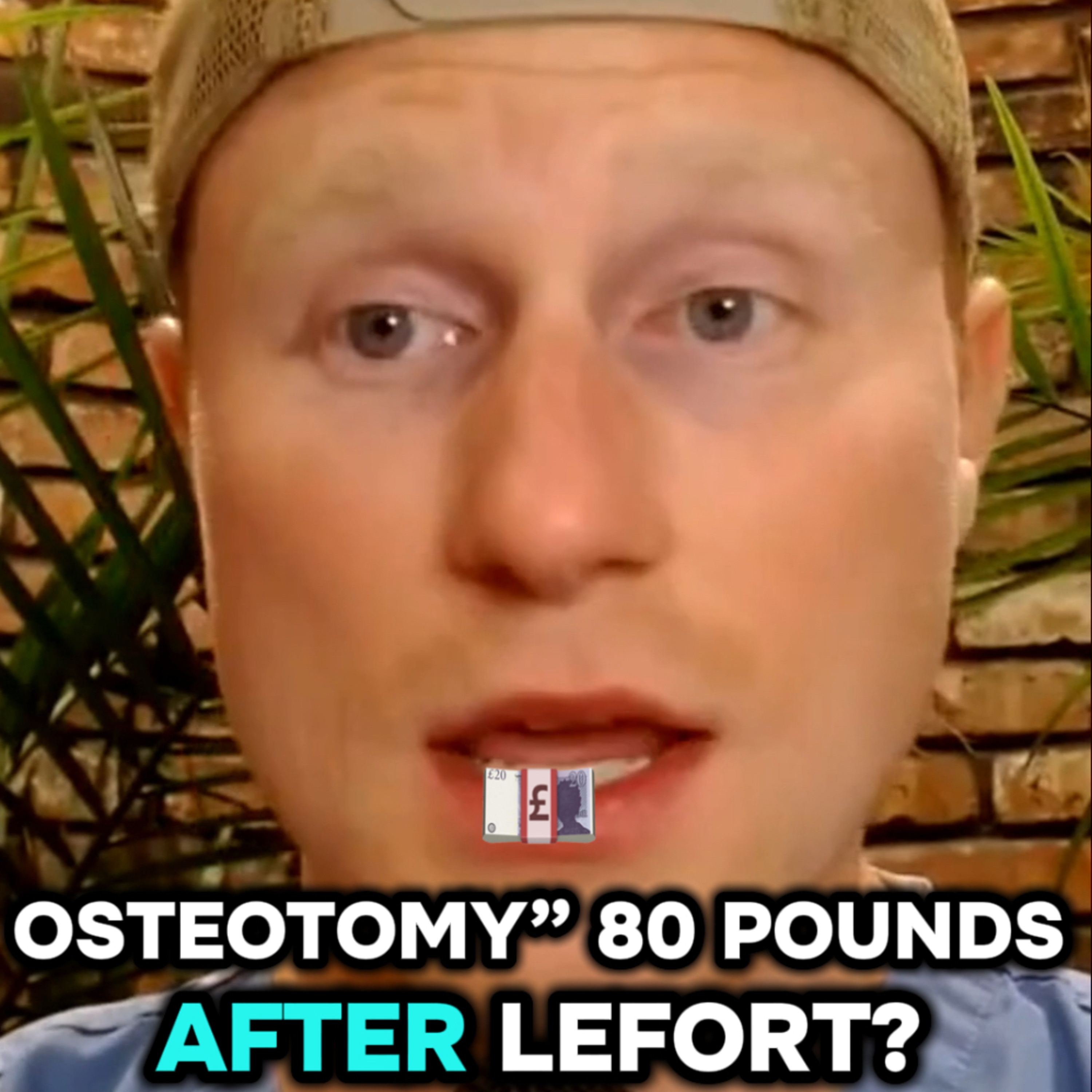 Weight Loss After Jaw Surgery