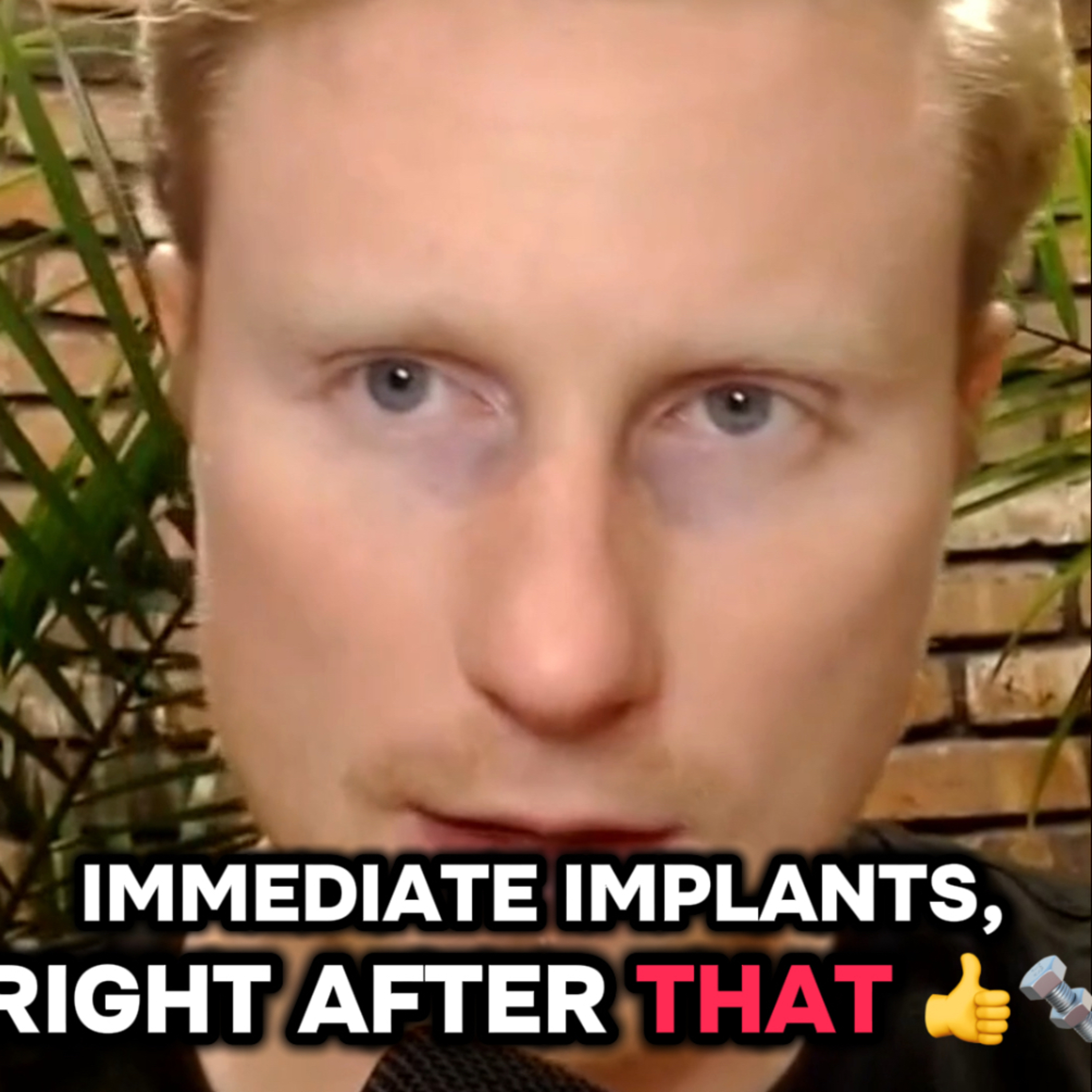 First Guided Implant Surgery In Private Practice