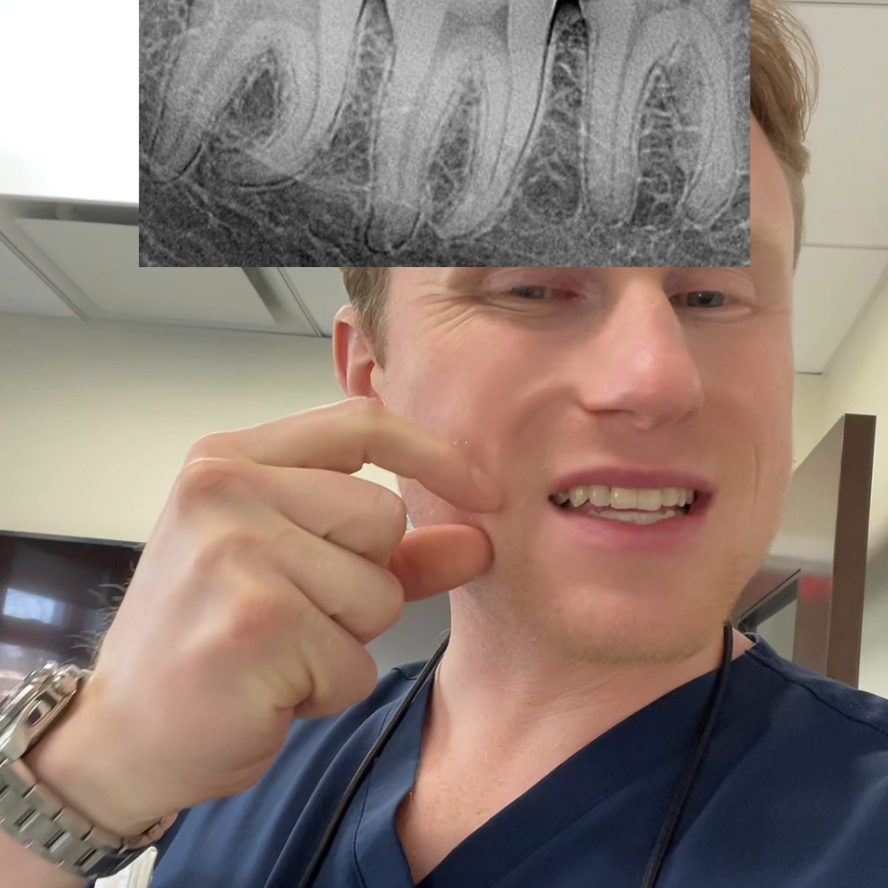 Different X-Rays Used In Dentistry (“Radiographs”)