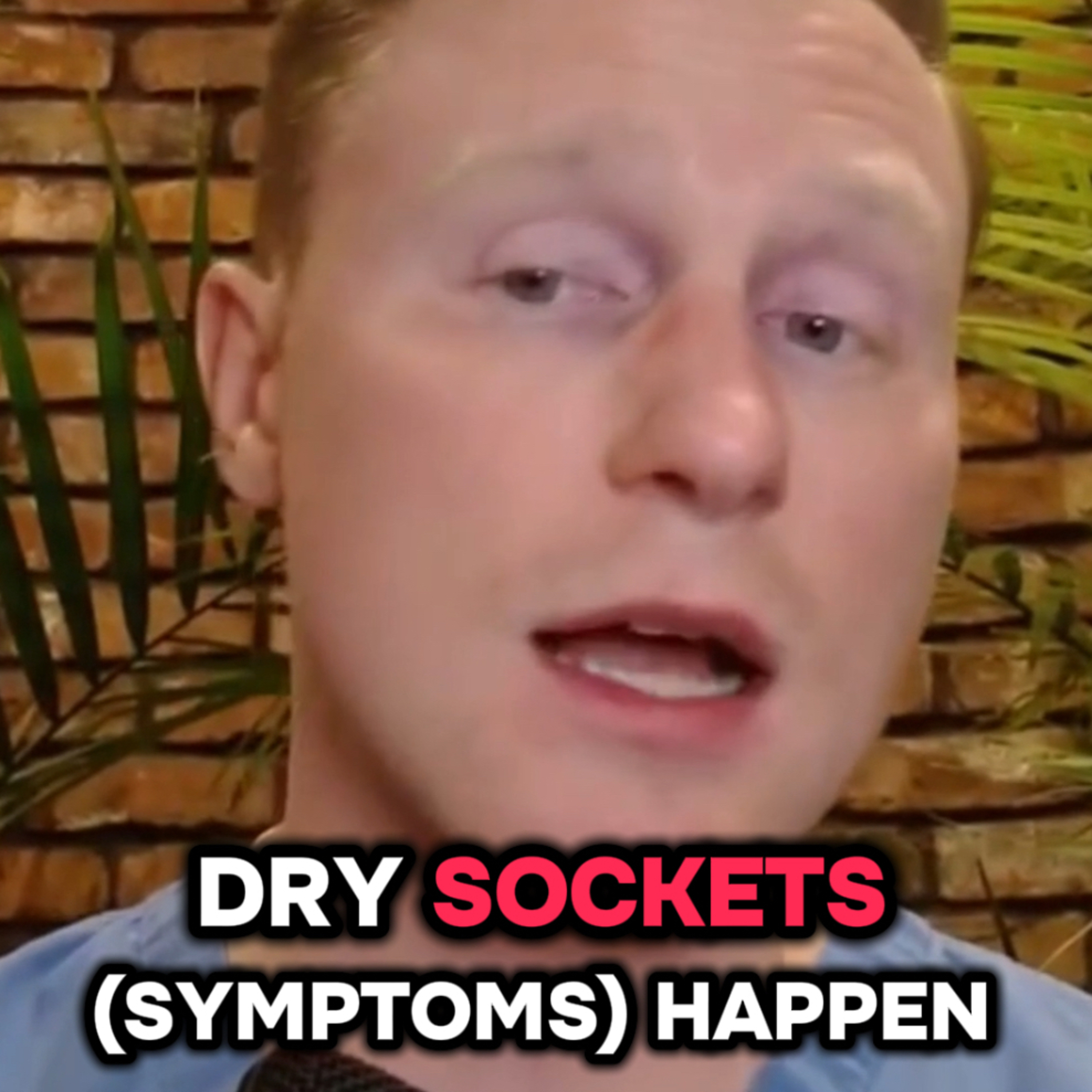 At What Day Are You Clear From “Dry Sockets?”