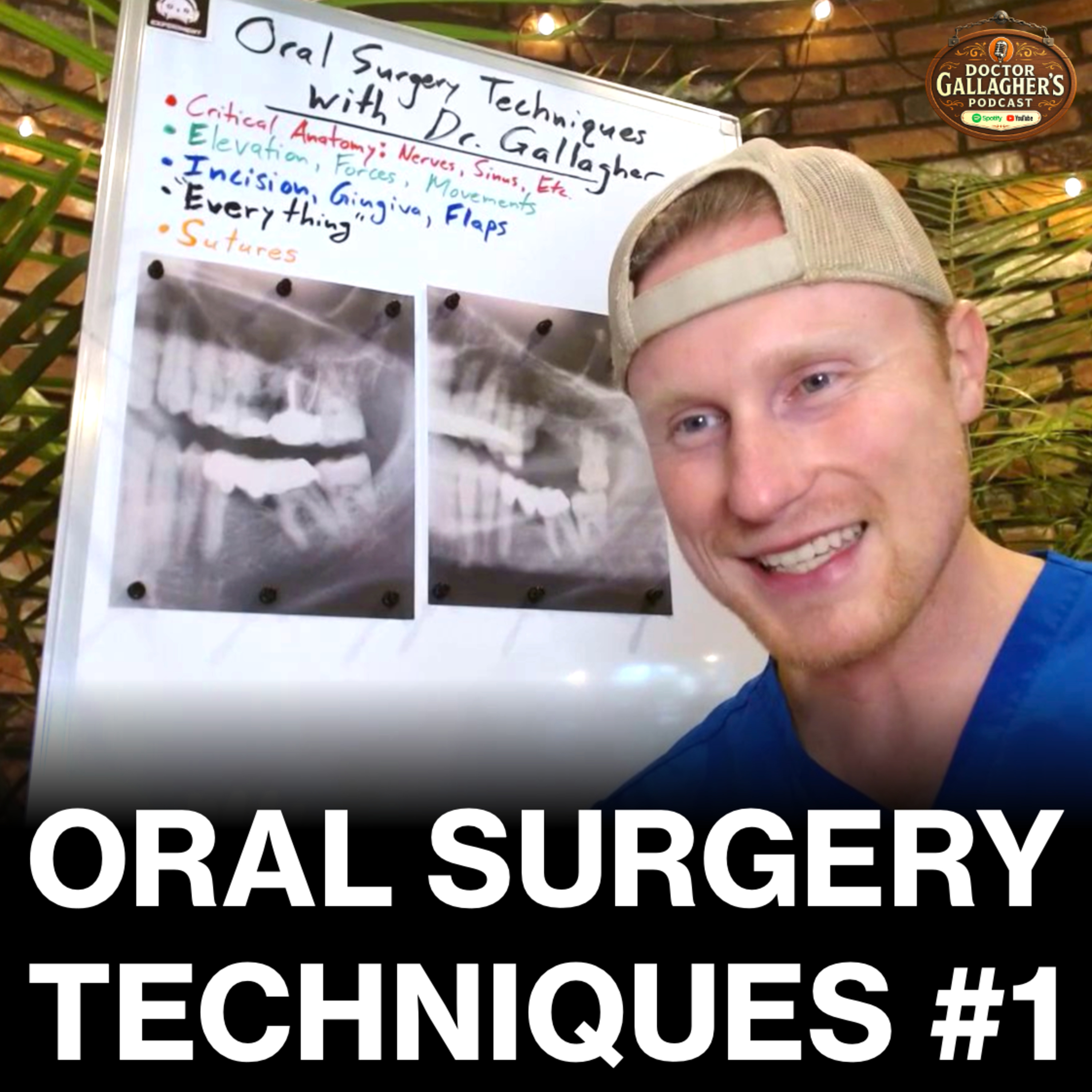 Extractions, Bone Graft, Sinus Lift, Membrane | Oral Surgery Techniques #1 with Dr. Gallagher