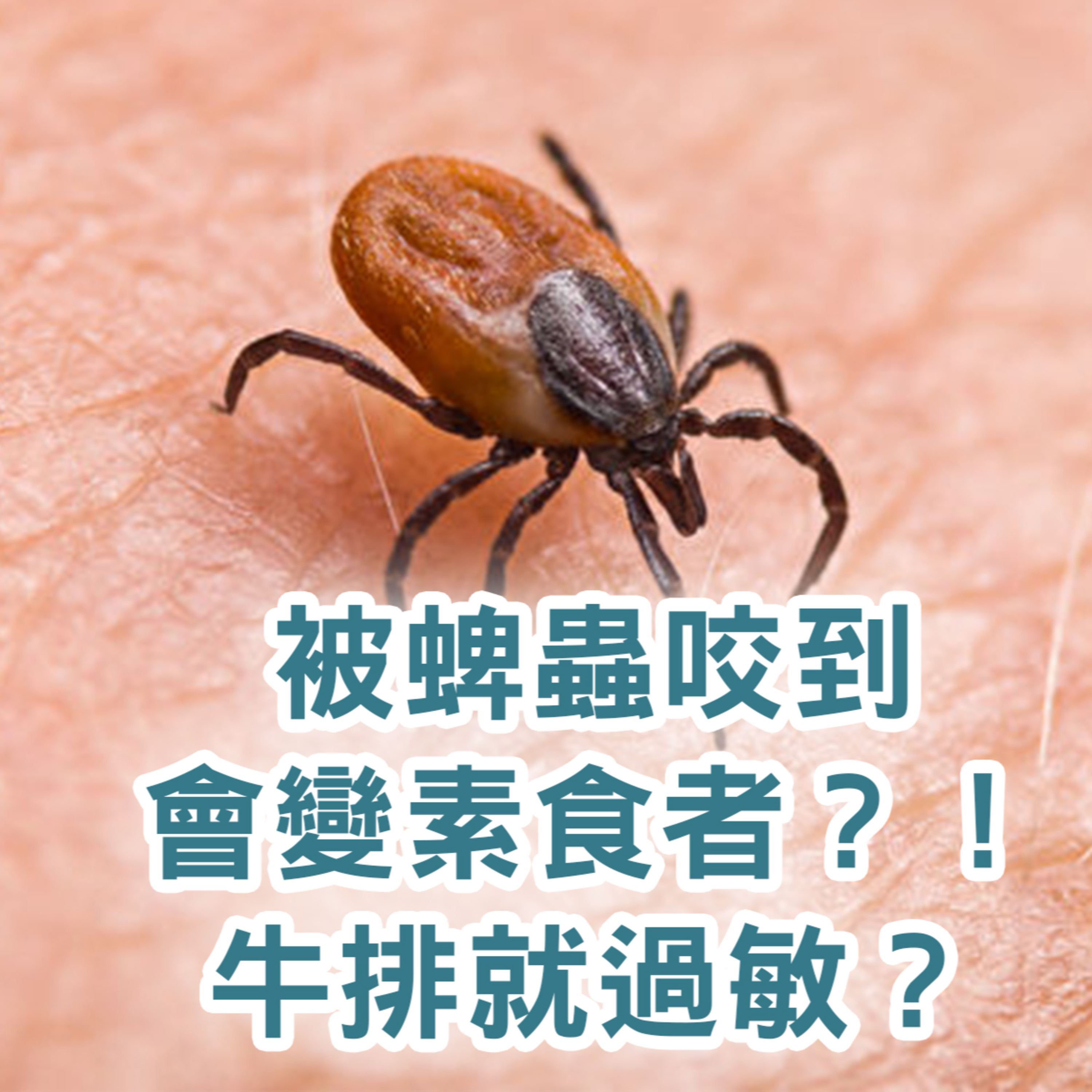 【S2 EP.104】被蜱蟲咬到會變素食者？！ 一吃牛排就過敏？