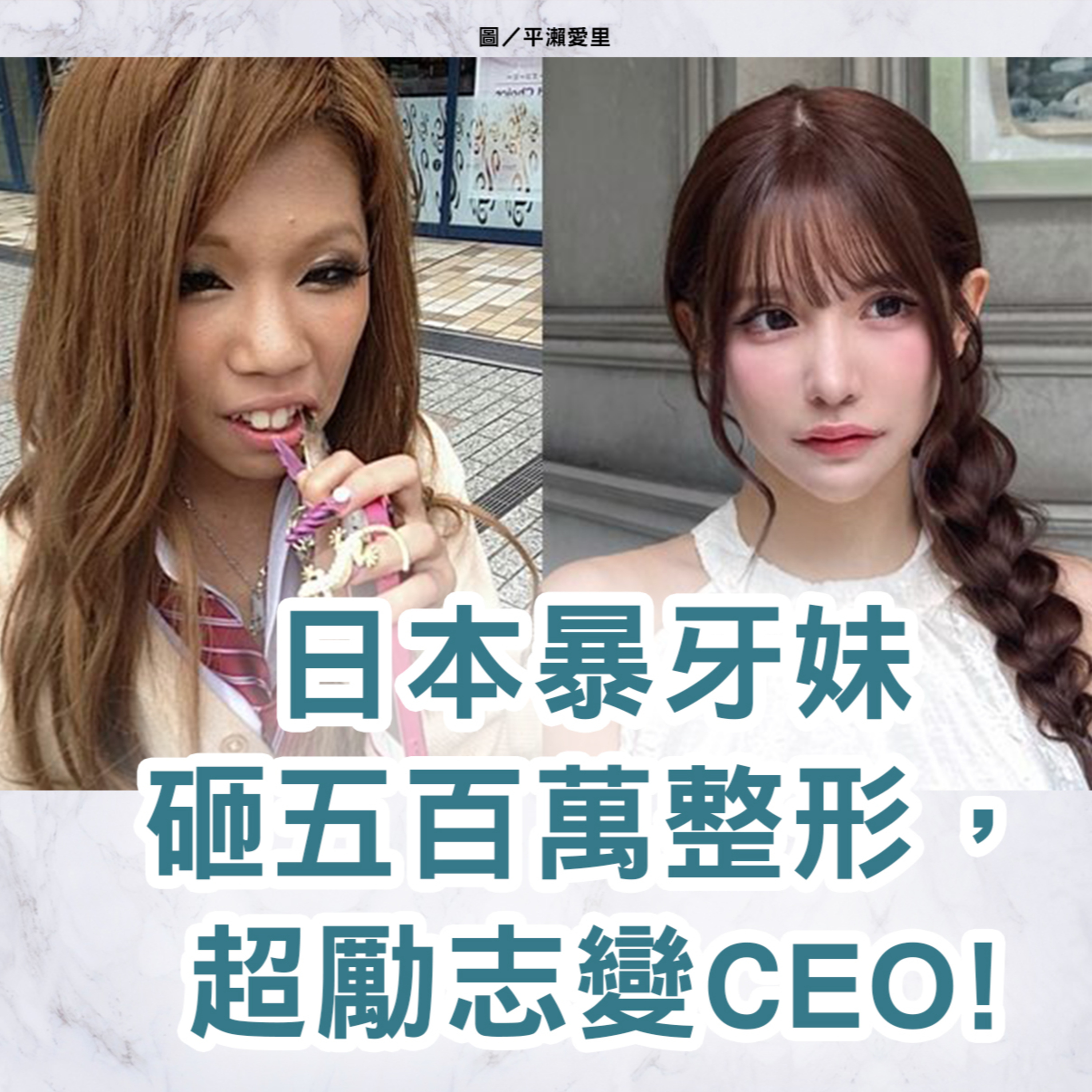 【S2 EP.105】日本暴牙妹砸五百萬整形，超勵志變CEO! 加碼：韓國皮膚科年會參加心得