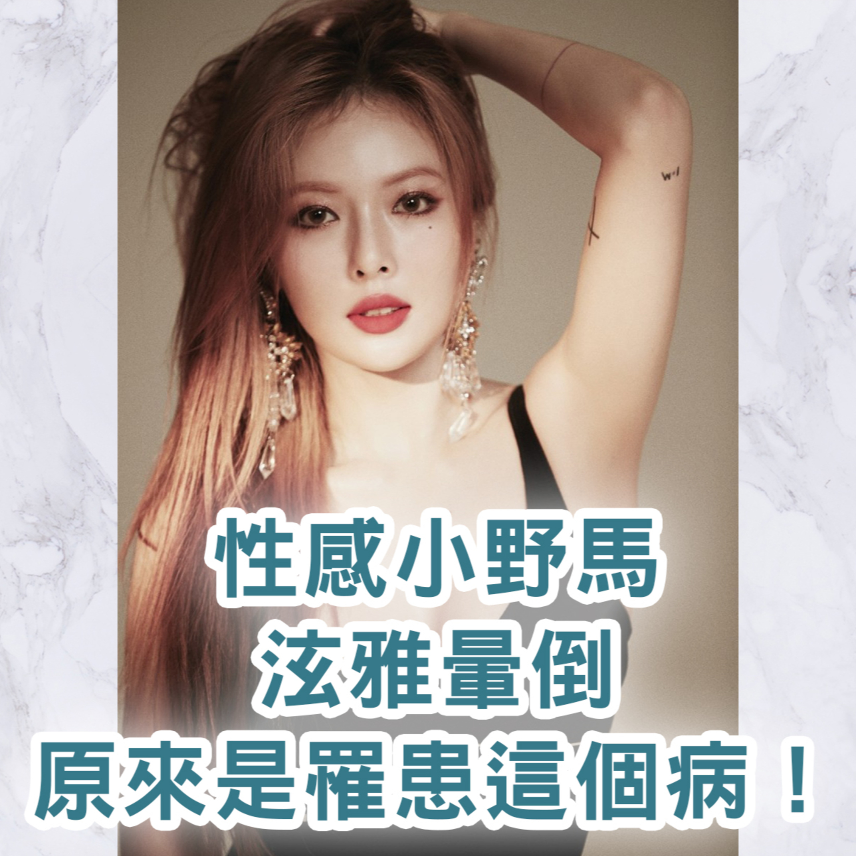【S2 EP.107】性感小野馬泫雅暈倒，原來是罹患這個病！