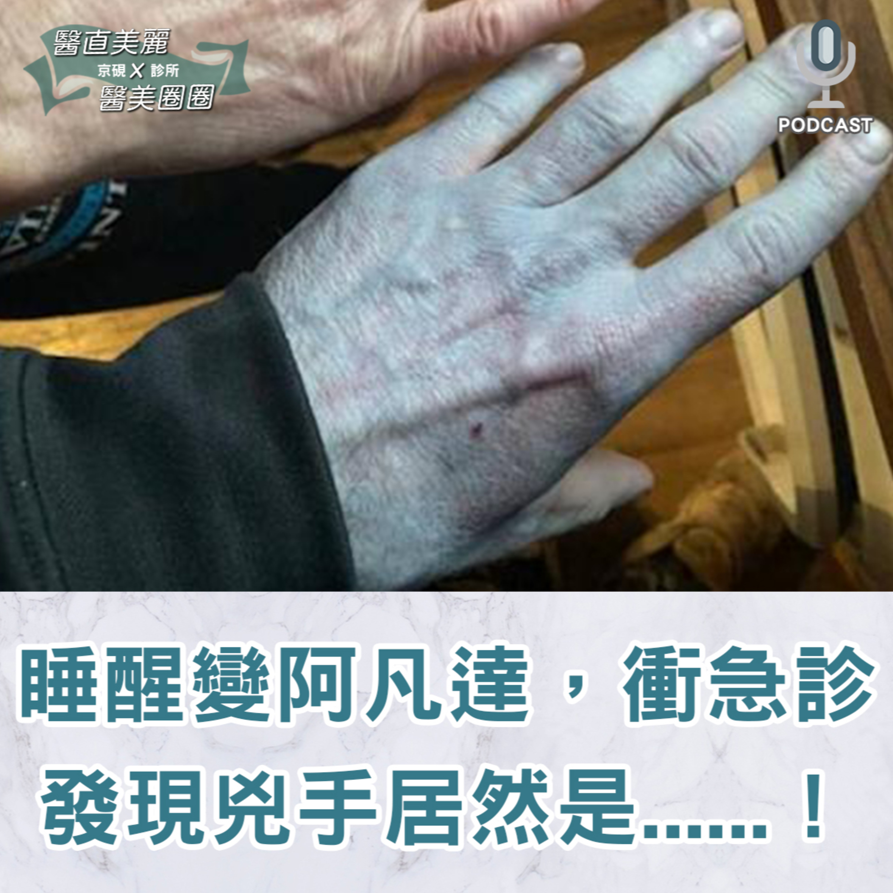 【S2 EP.140】男子睡醒變阿凡達，衝急診驚訝發現兇手居然是......！