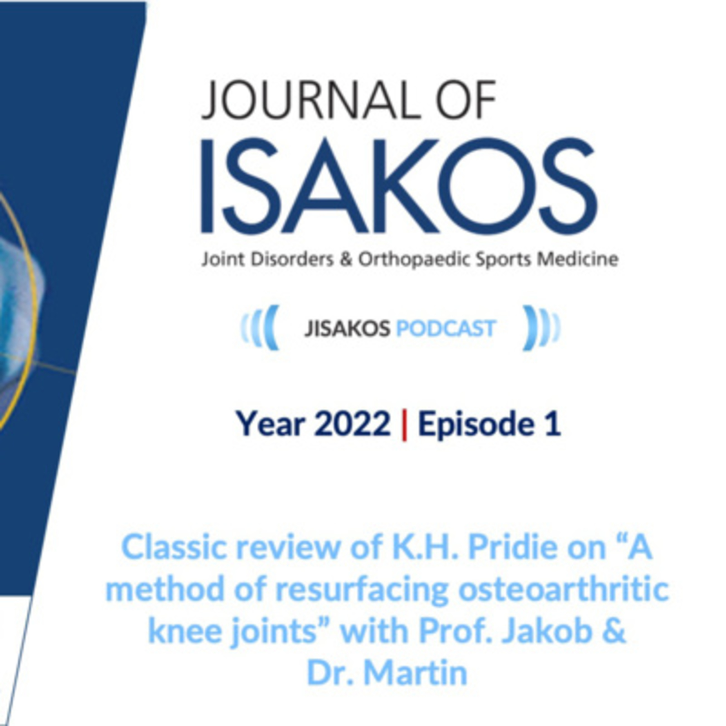 Classic review of K.H. Pridie on “A method of resurfacing osteoarthritic knee joints episode artwork