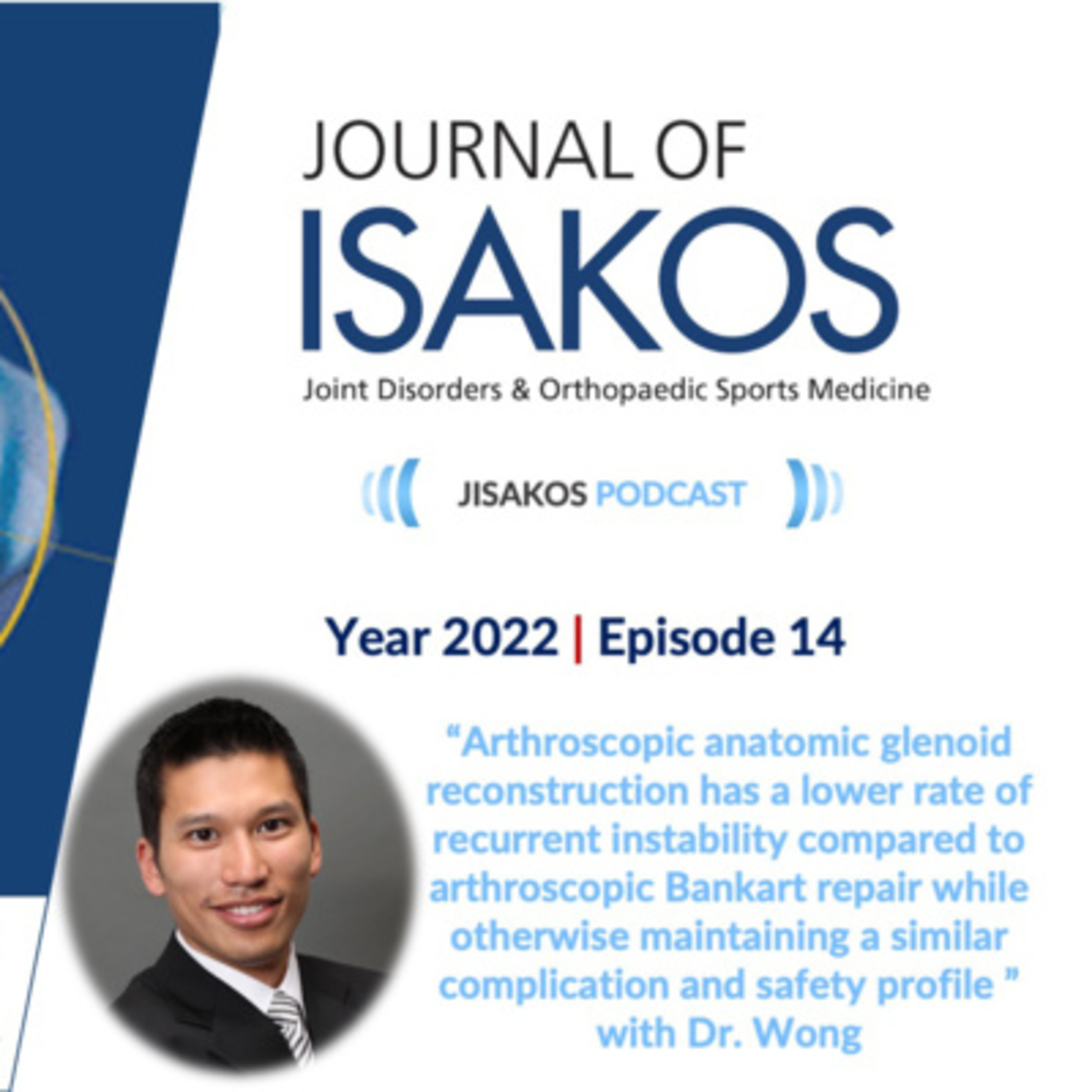 Arthroscopic anatomic glenoid reconstruction has a lower rate of recurrent instability compared to arthroscopic Bankart repair while otherwise maintaining a similar complication and safety profile episode artwork