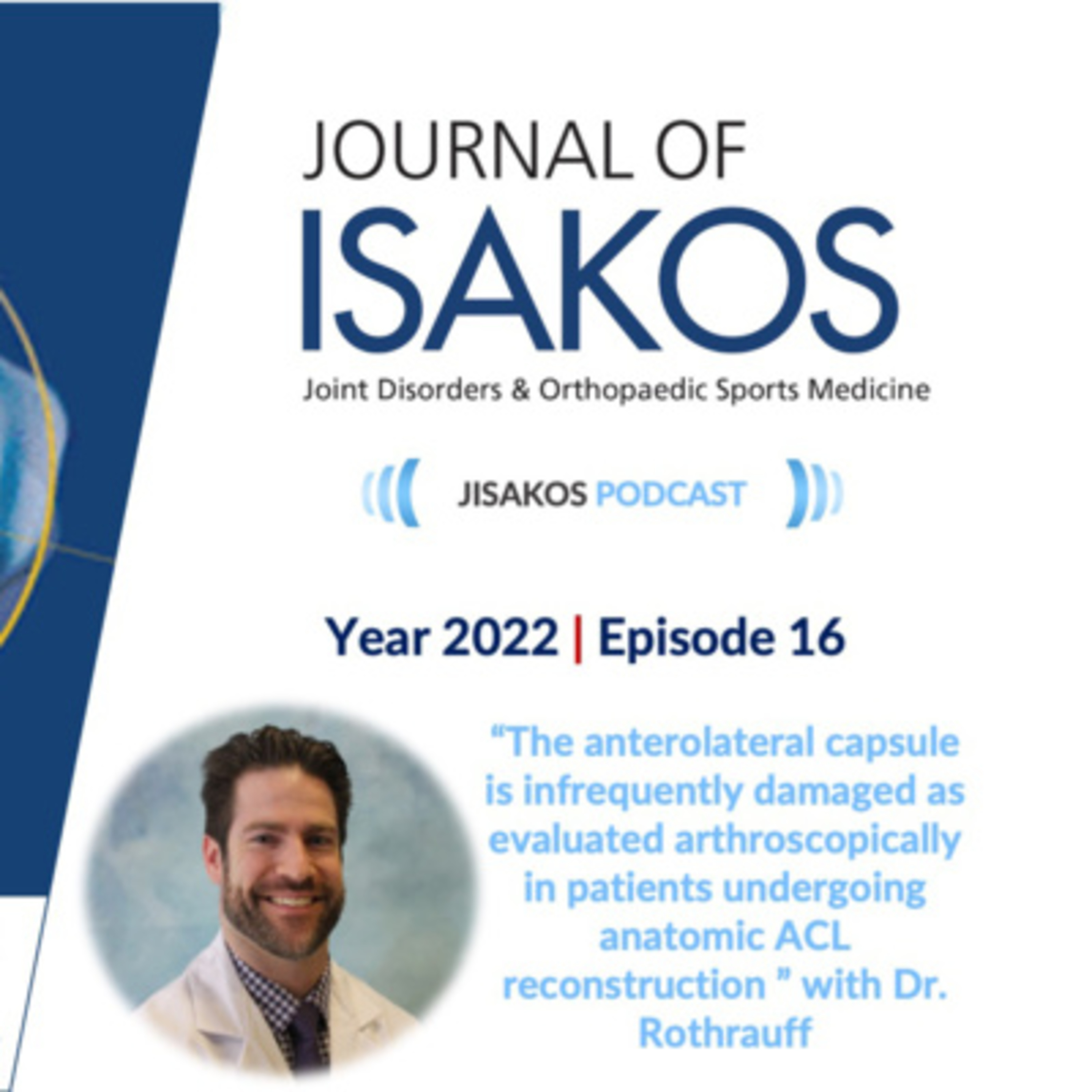 The anterolateral capsule is infrequently damaged as evaluated arthroscopically in patients undergoing anatomic ACL reconstruction episode artwork