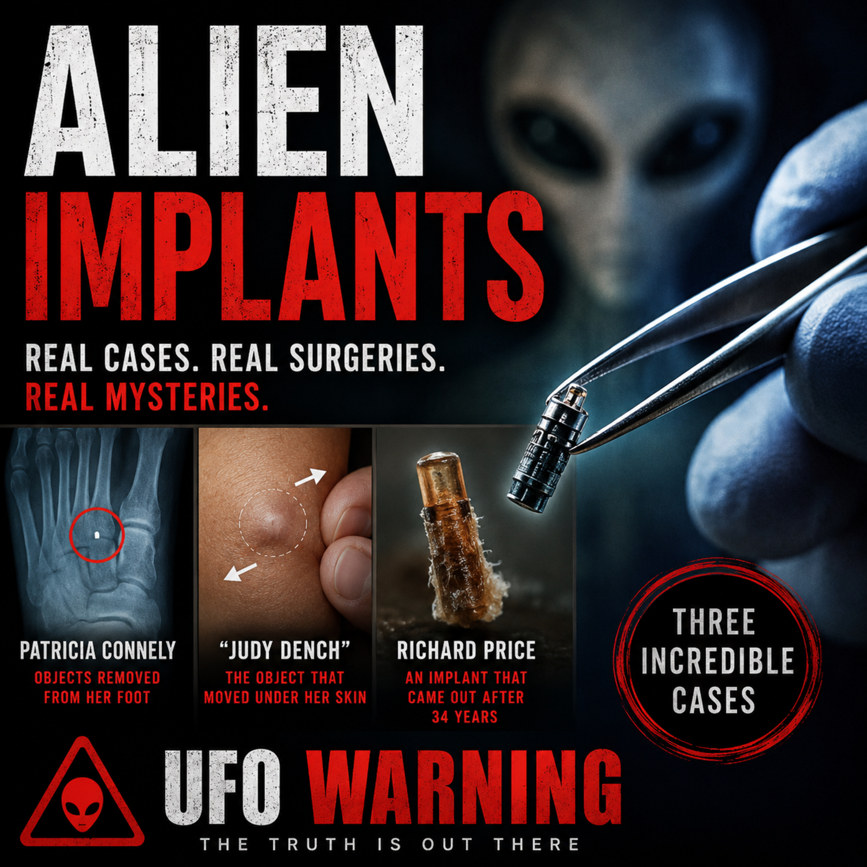 DR. LEIRR'S ALIEN IMPLANTS episode artwork