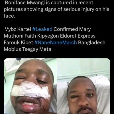FALSE: These photos showing an injured Boniface Mwangi are not recent