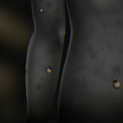 Ticks