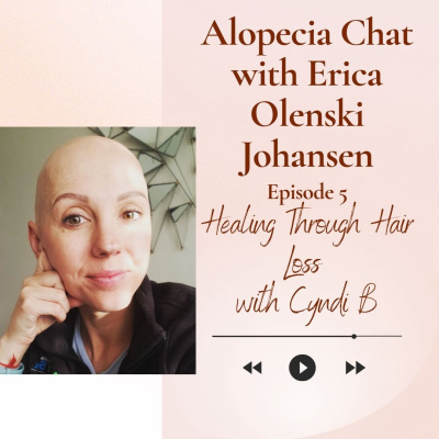 Alopecia Chat with Erica Olenski Johansen Alopecia Chat with Erica Olenski Johansen
