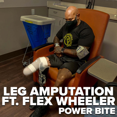 Flex Wheeler's Leg Amputation Explained ft. Flex Wheeler by Mark Bell's
