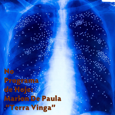 No Programa de Hoje: Marlon De Paula- "Terra Vinga”