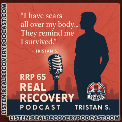 RRP Episode 65 – Tristan S.: Strength in the Scars—Seven Overdoses and the Road to Recovery