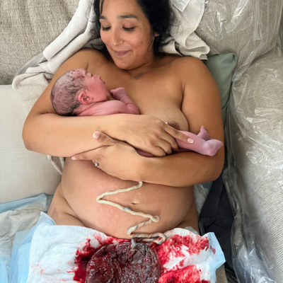 69. Raquel’s breech homebirth after three cesareans with a bicornuate uterus