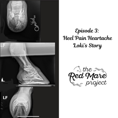 E3 Heel Pain Heartache: Loki's story