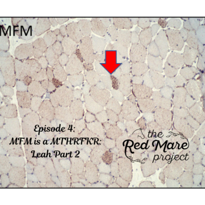 E4: MFM is a MTHRFKR, Leah part 2